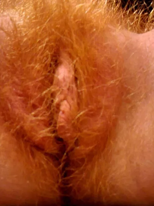 flames by ababypinecone