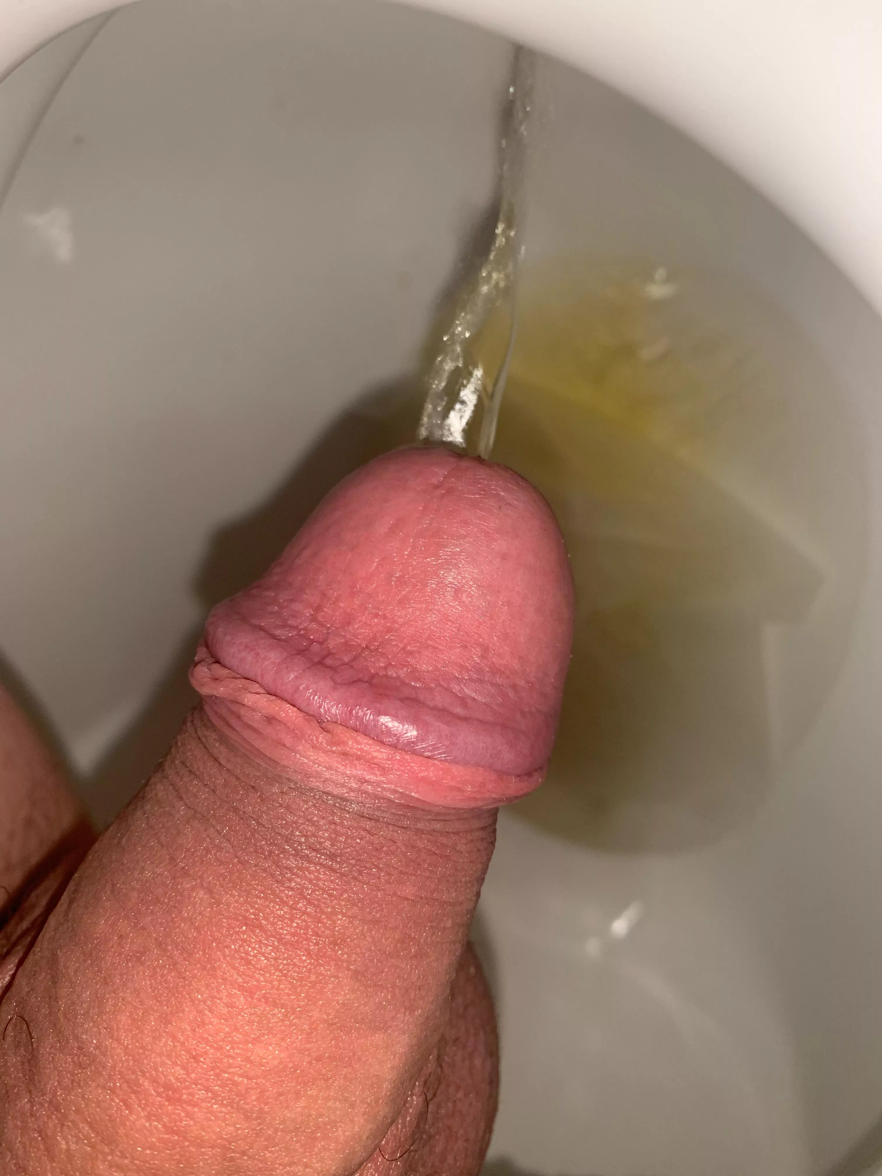 Should I share every time I pee? posted by AdPleasant6579