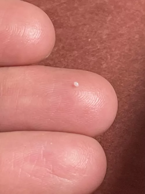 A shiny little skin pearl by Headph0nes12