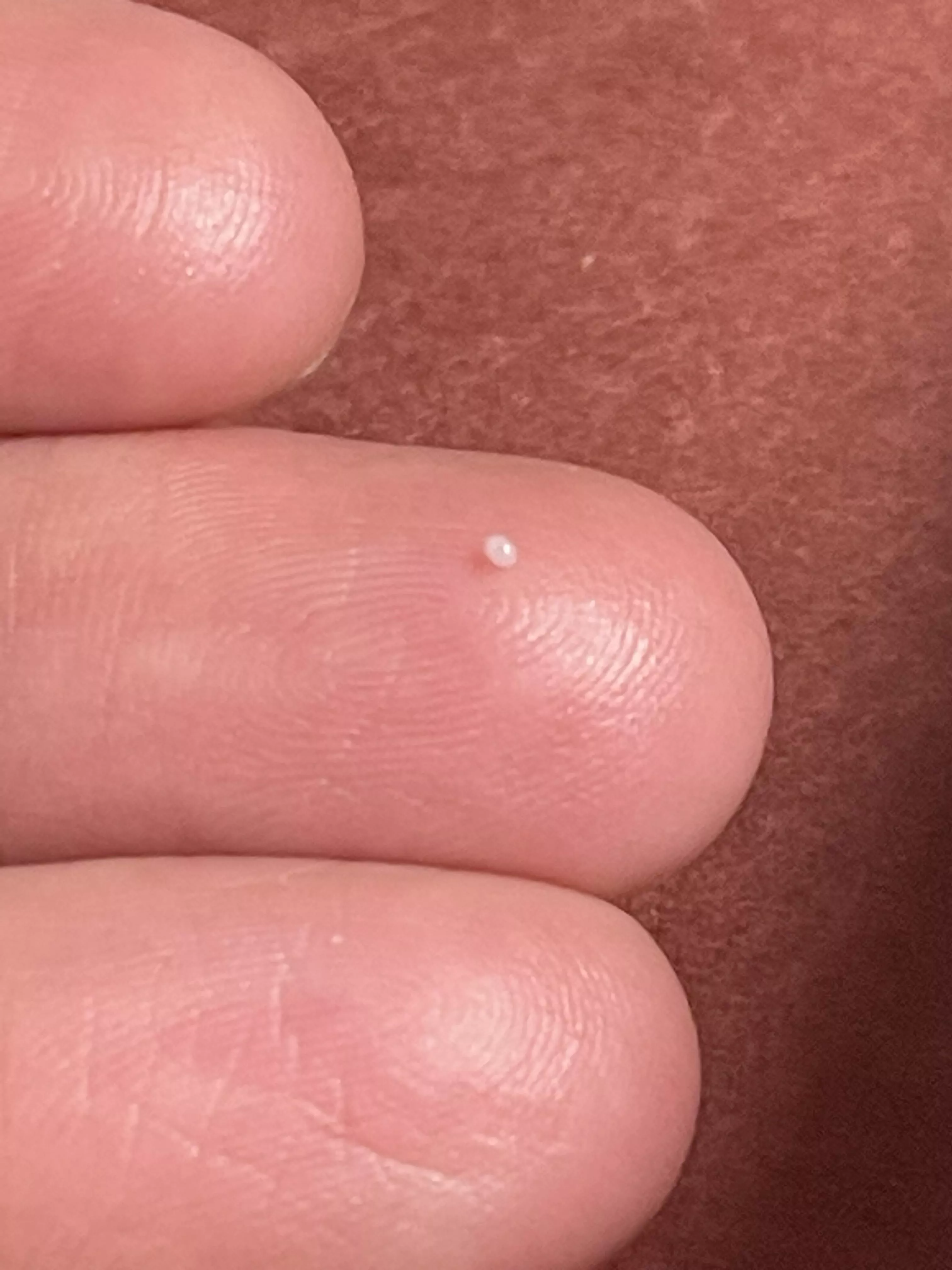 A shiny little skin pearl posted by Headph0nes12