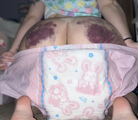 Bunny friends to hide the bruises 🤭 by Peachythesub