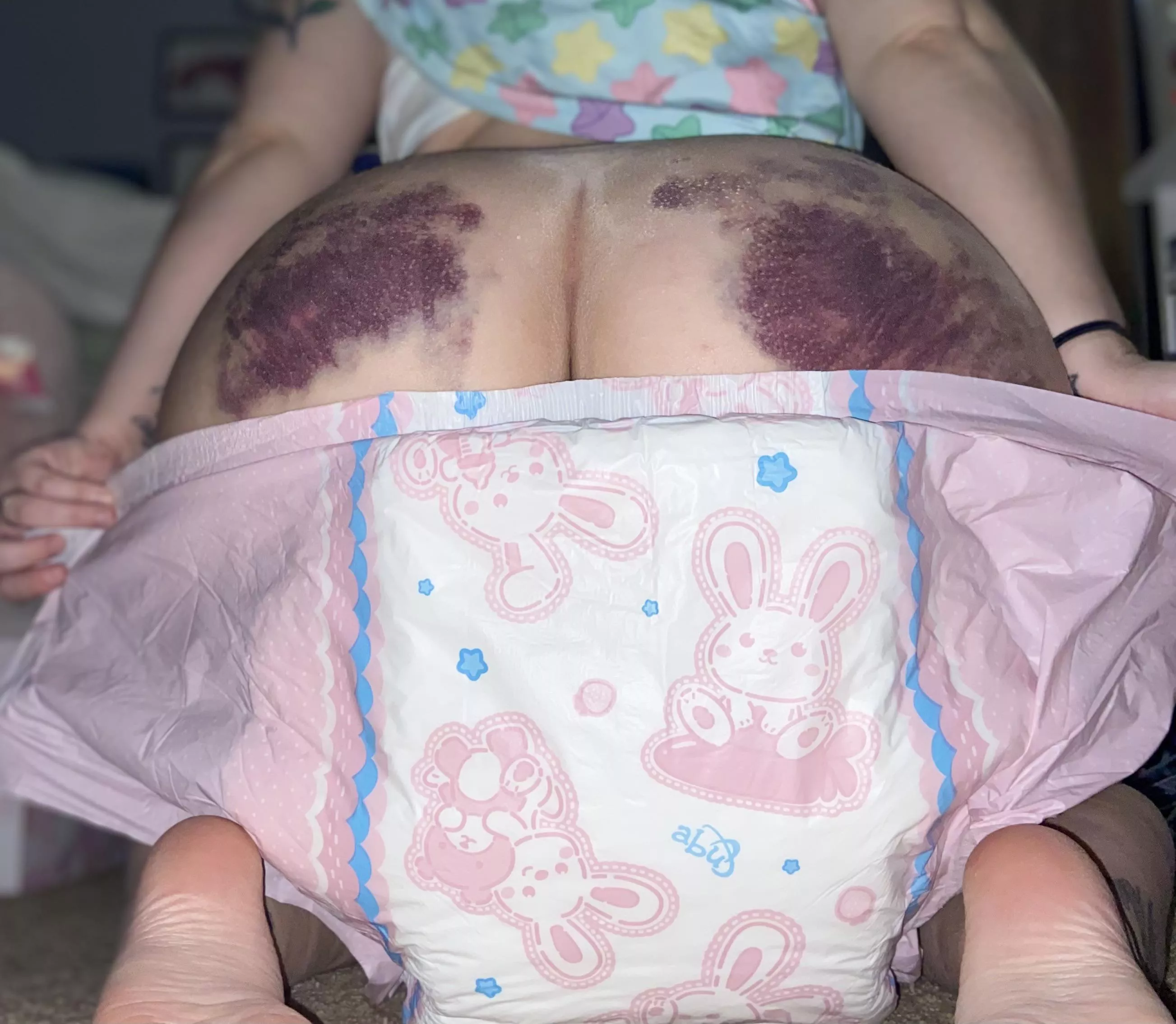 Bunny friends to hide the bruises 🤭 posted by Peachythesub