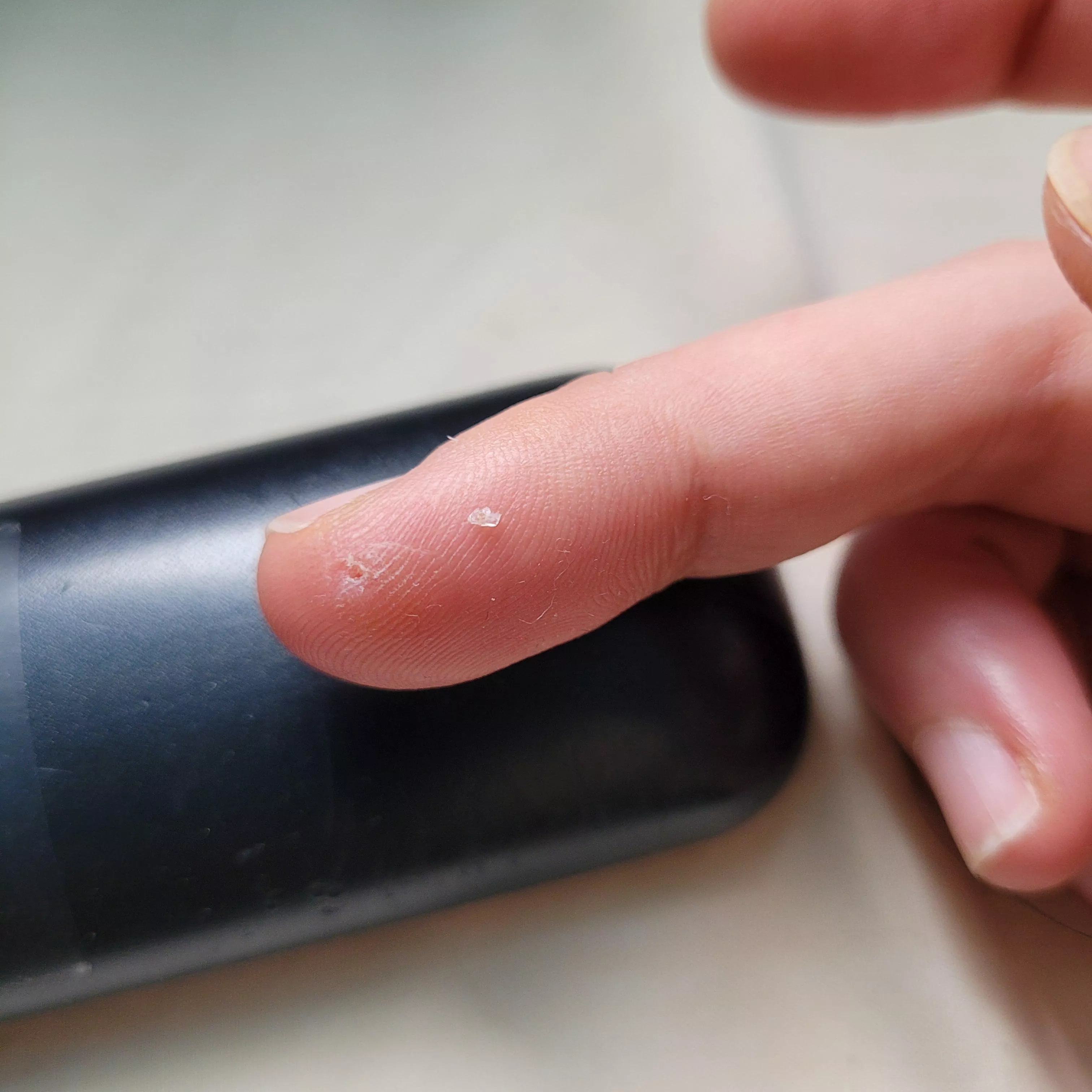 Cut my finger with broken glass over a month ago. It was still very sensitive even after scarring. Then a tiny bump appeared - just plucked this tiny piece of glass out. Relief posted by greenrees