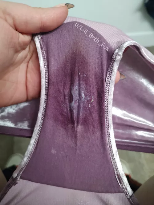 Day 2 of 3... The cream from the previous day is alllll soaked in! by Lili_Beth_Fox