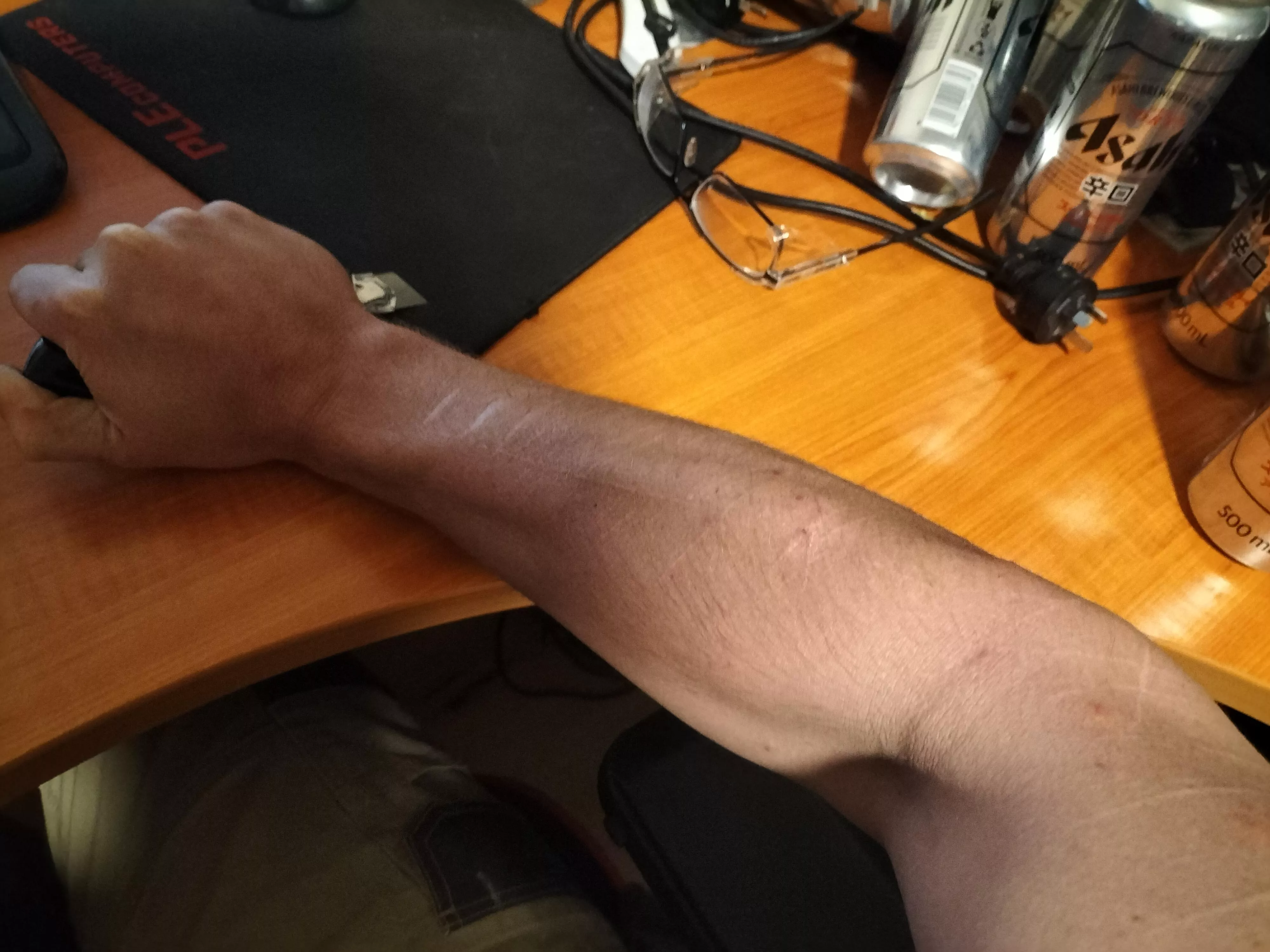 A bit odd, but I've been told it does it for some posted by yewfokkentwattedim