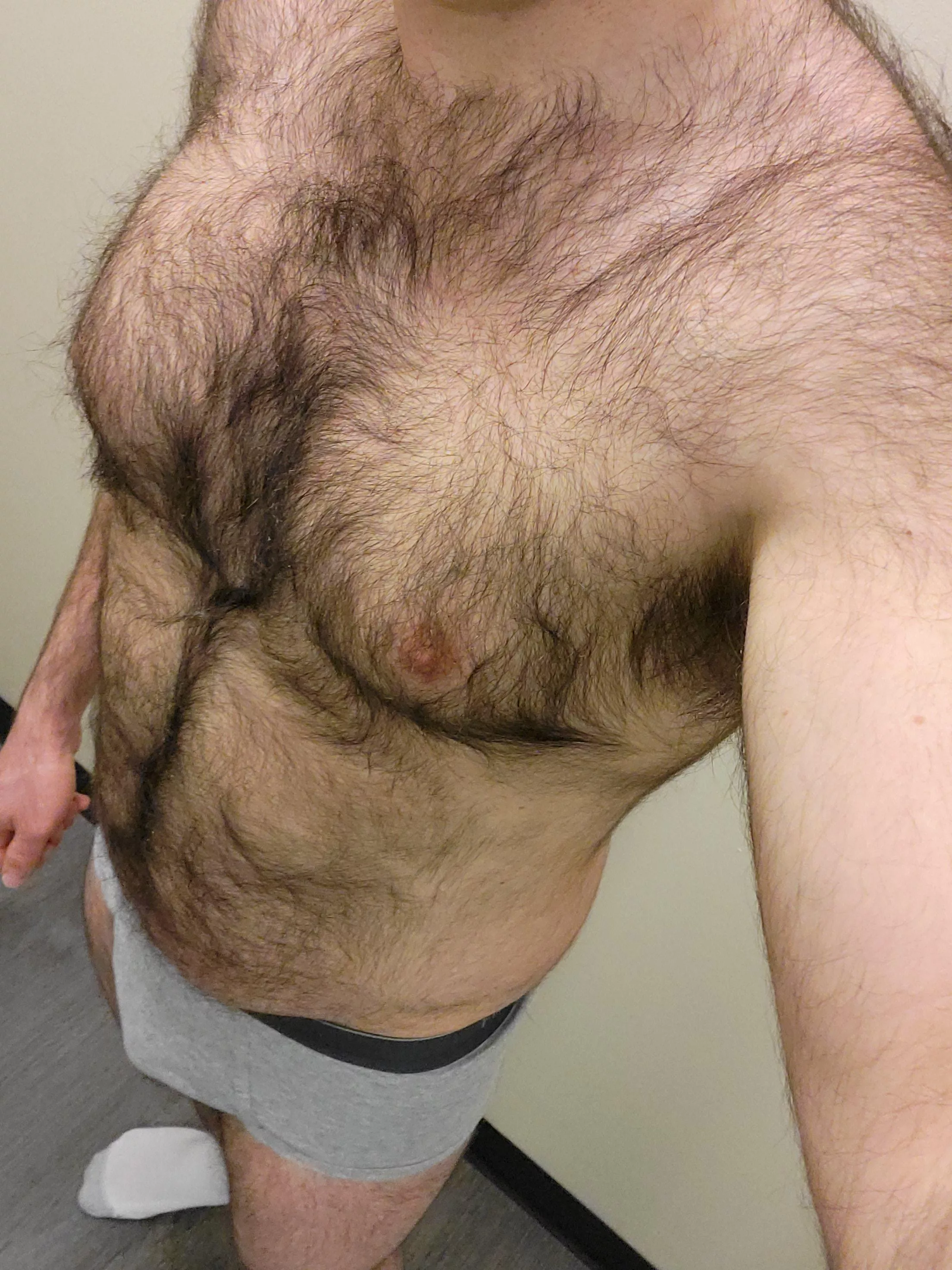 Someone once asked me if my body hair saves me from having to use sunscreen. Spoiler: It does not posted by Decent_Negotiation59