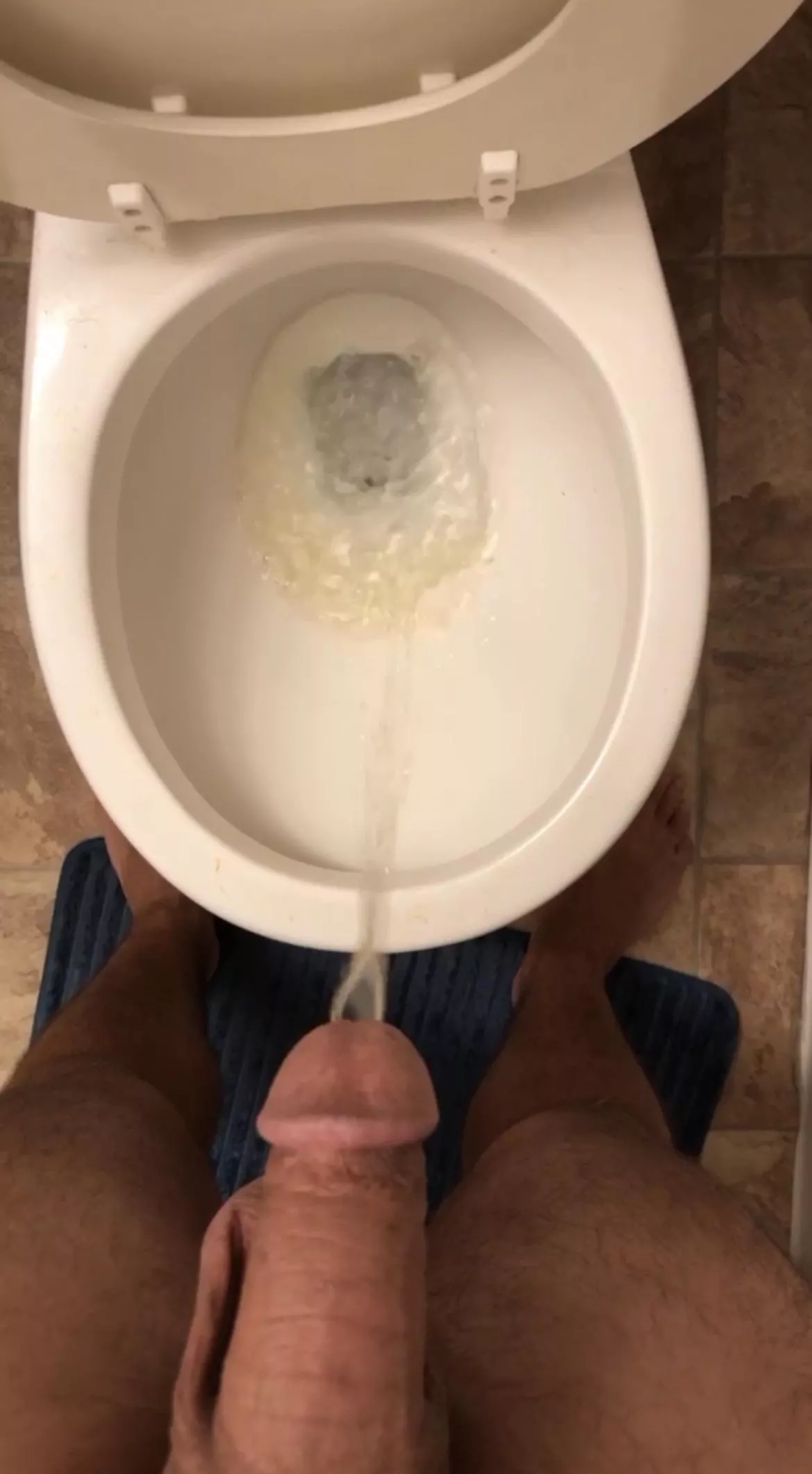 The next one is going on your body posted by anonplayer13