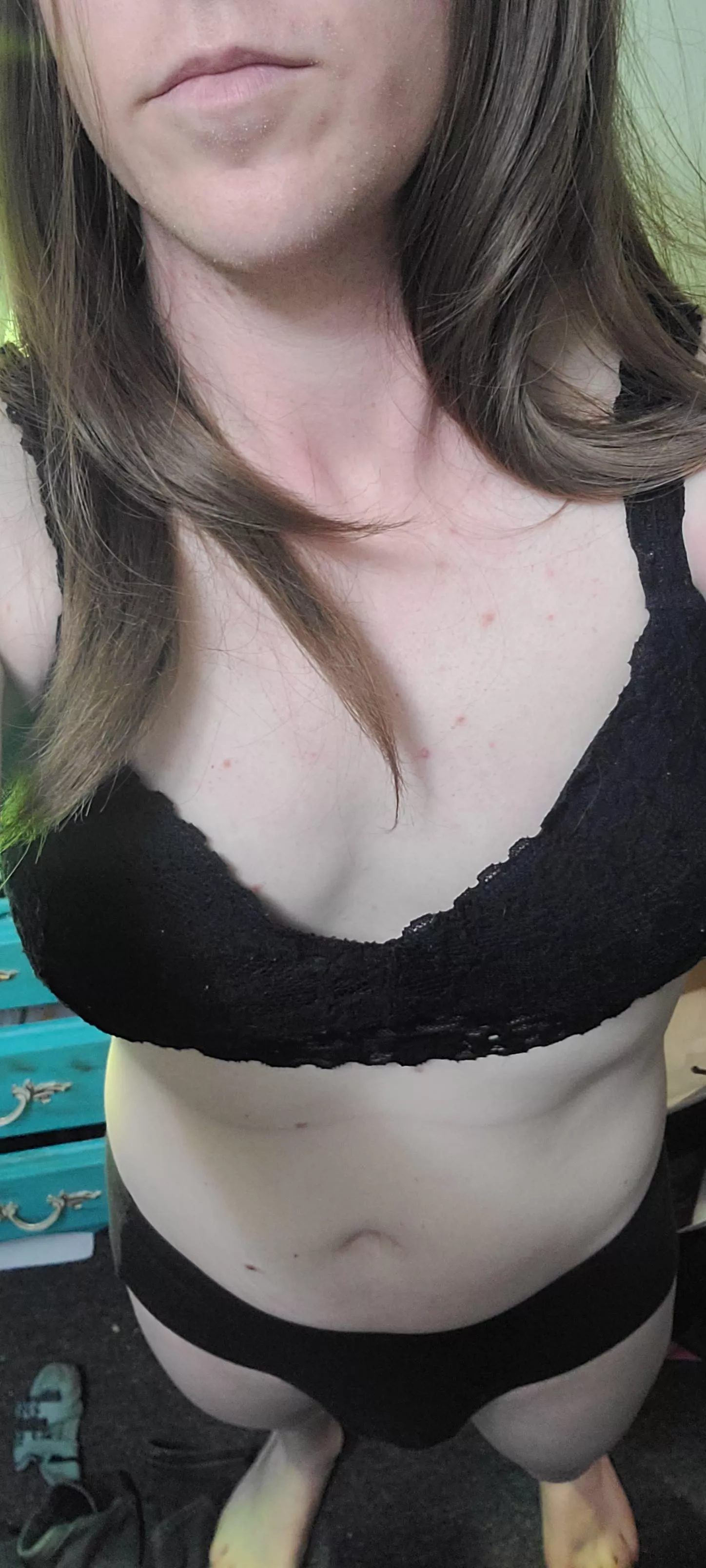 too much skin? posted by mental_chaos_