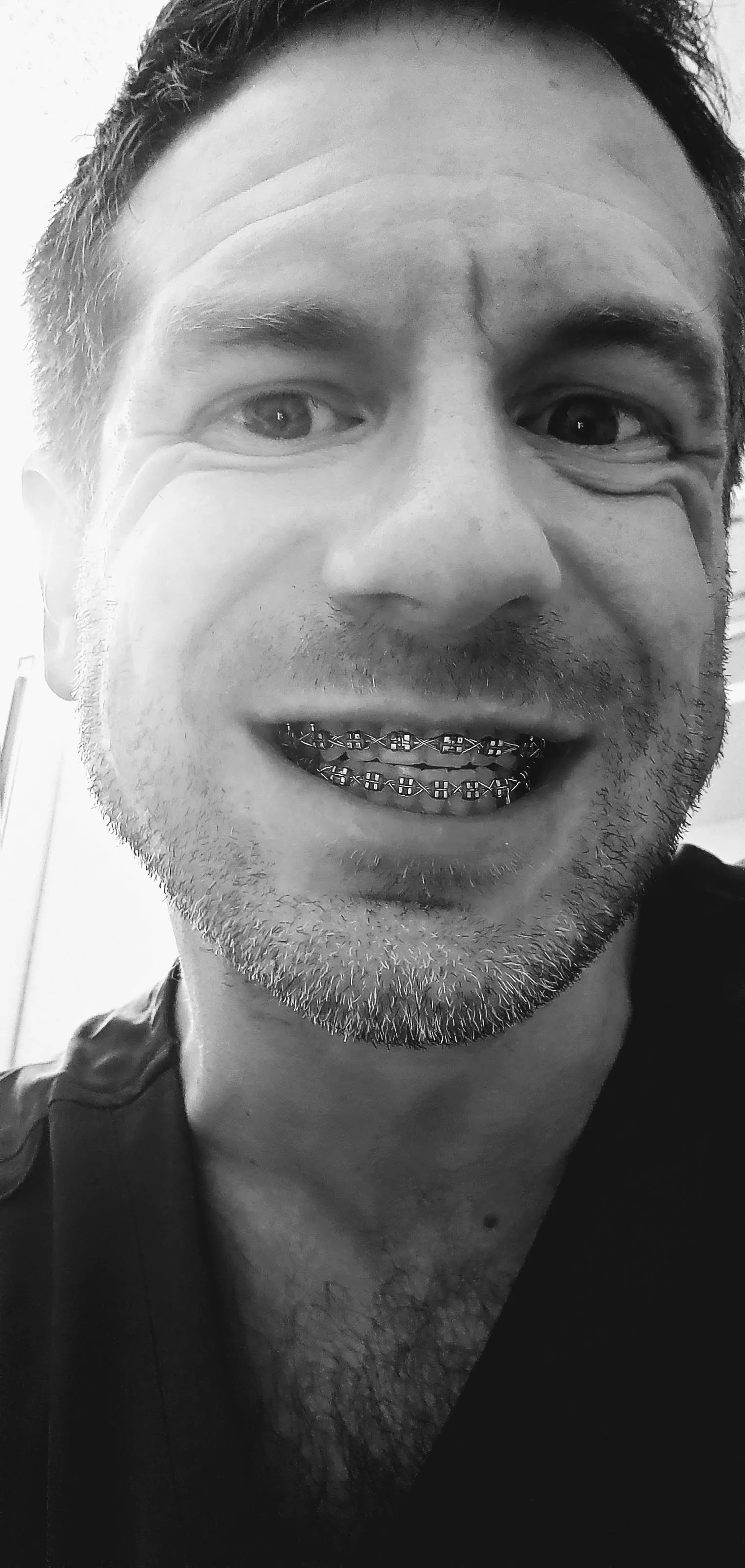 Hey Guys! TGIF 💖 #metalmouth posted by metalmouthkiss