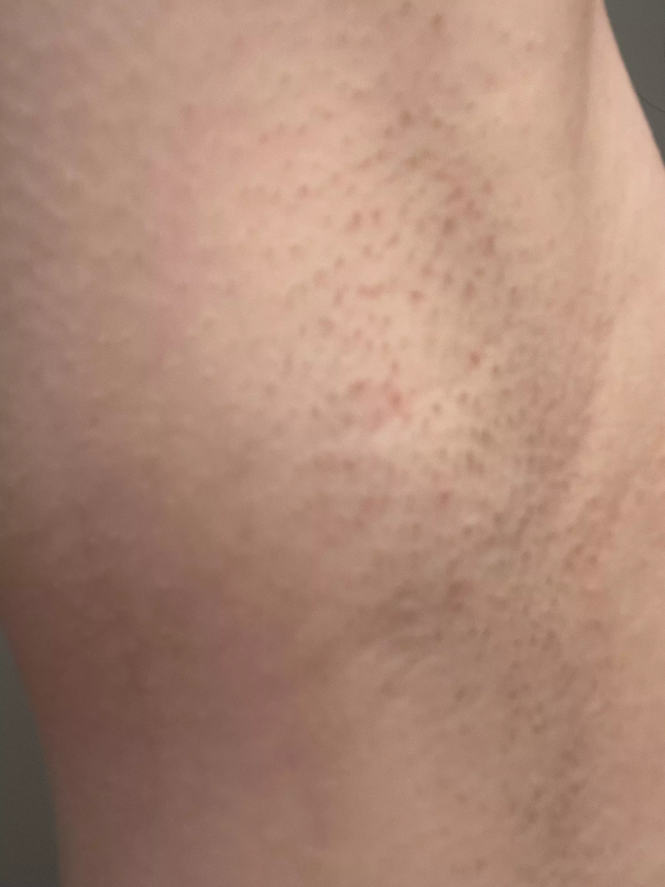 Stubble coming in posted by prettygirlpics