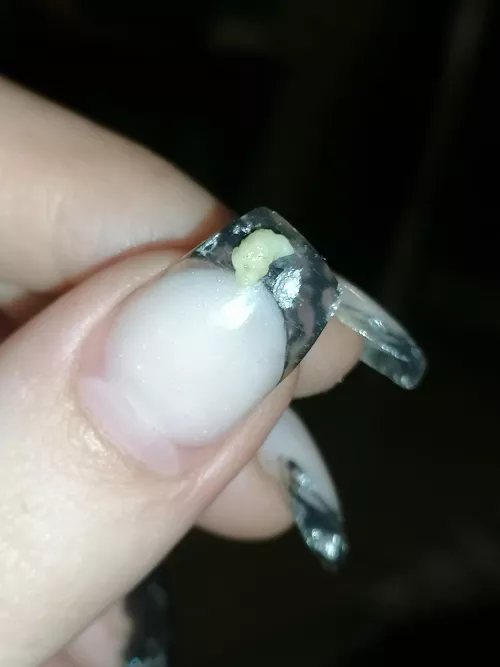 Tonsil stone that came out with a light cough. OC by wtfisthiseven1313