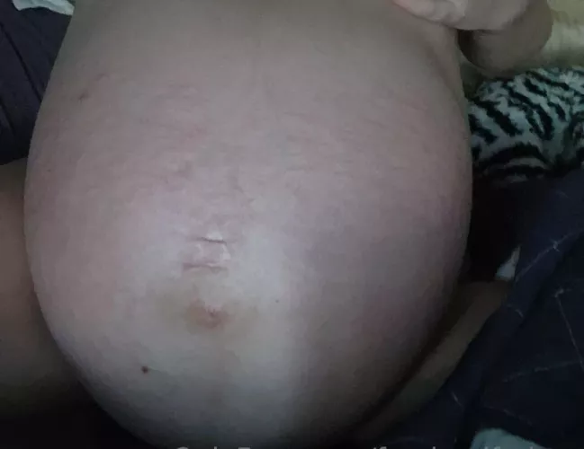 Twins are about to pop! by awolf1357