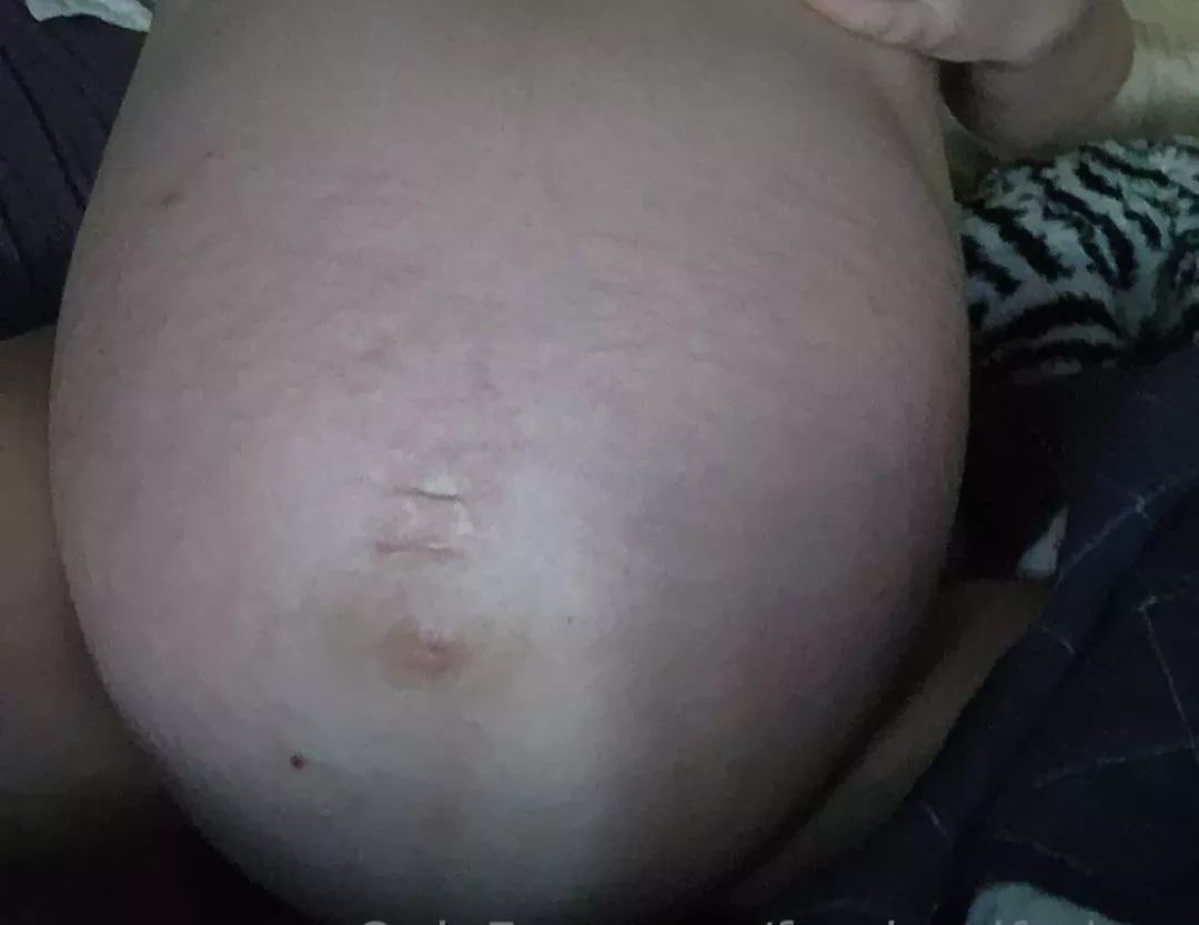 Twins are about to pop! posted by awolf1357