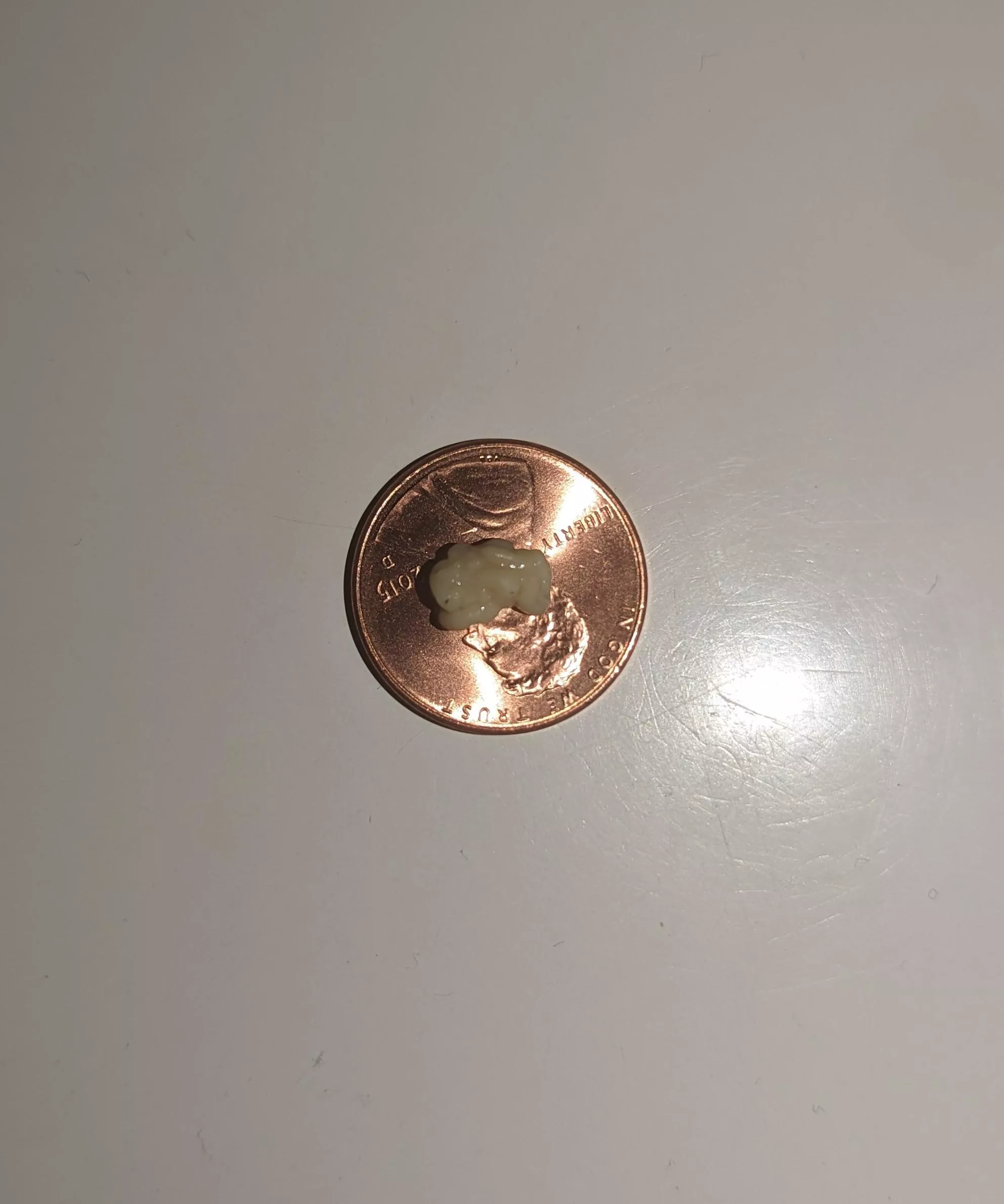 four score and 7 minutes ago I coughed out this tonsil stone posted by nibbles0