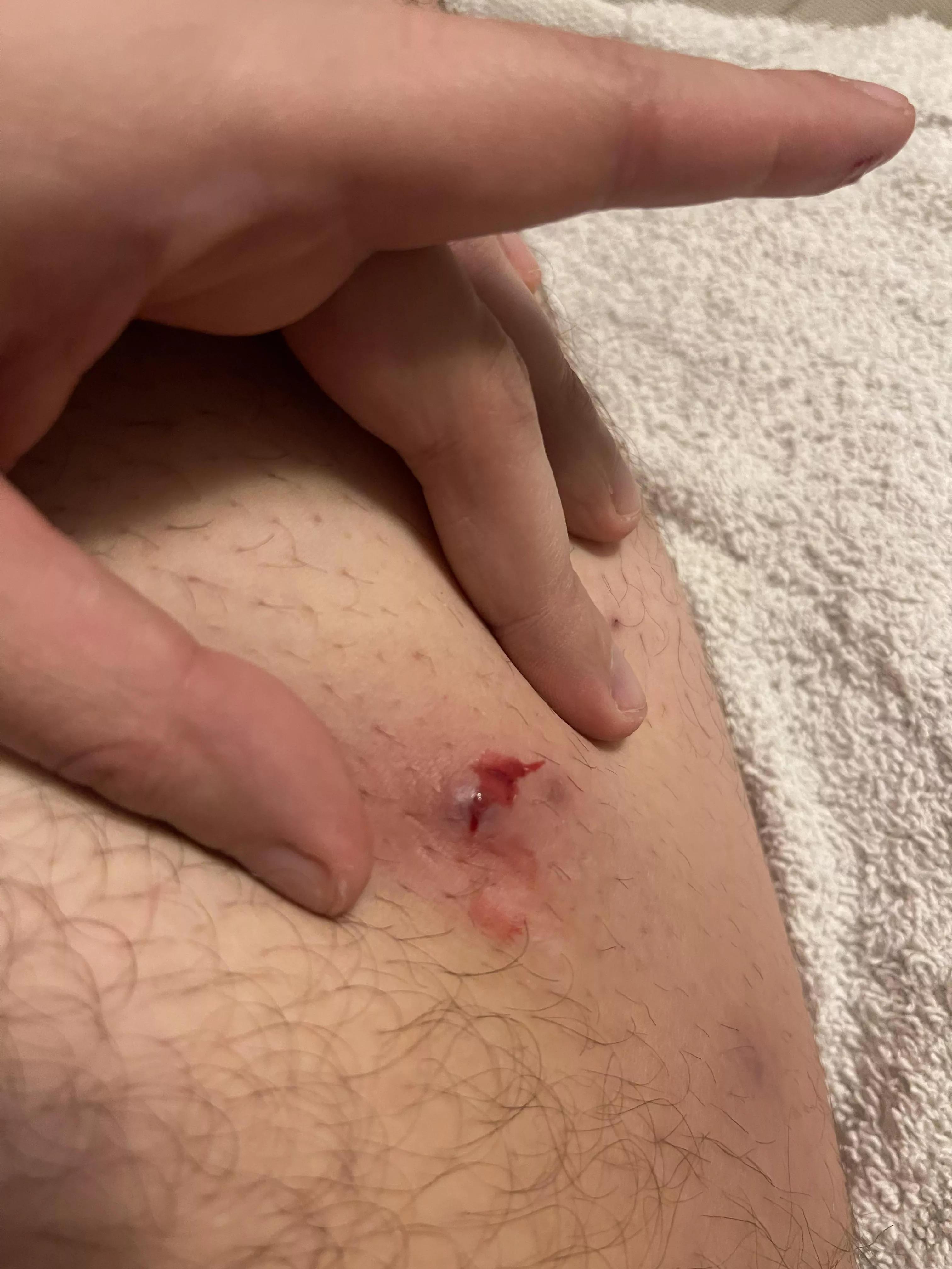 Think i finally got it this time posted by powerliftingteacher