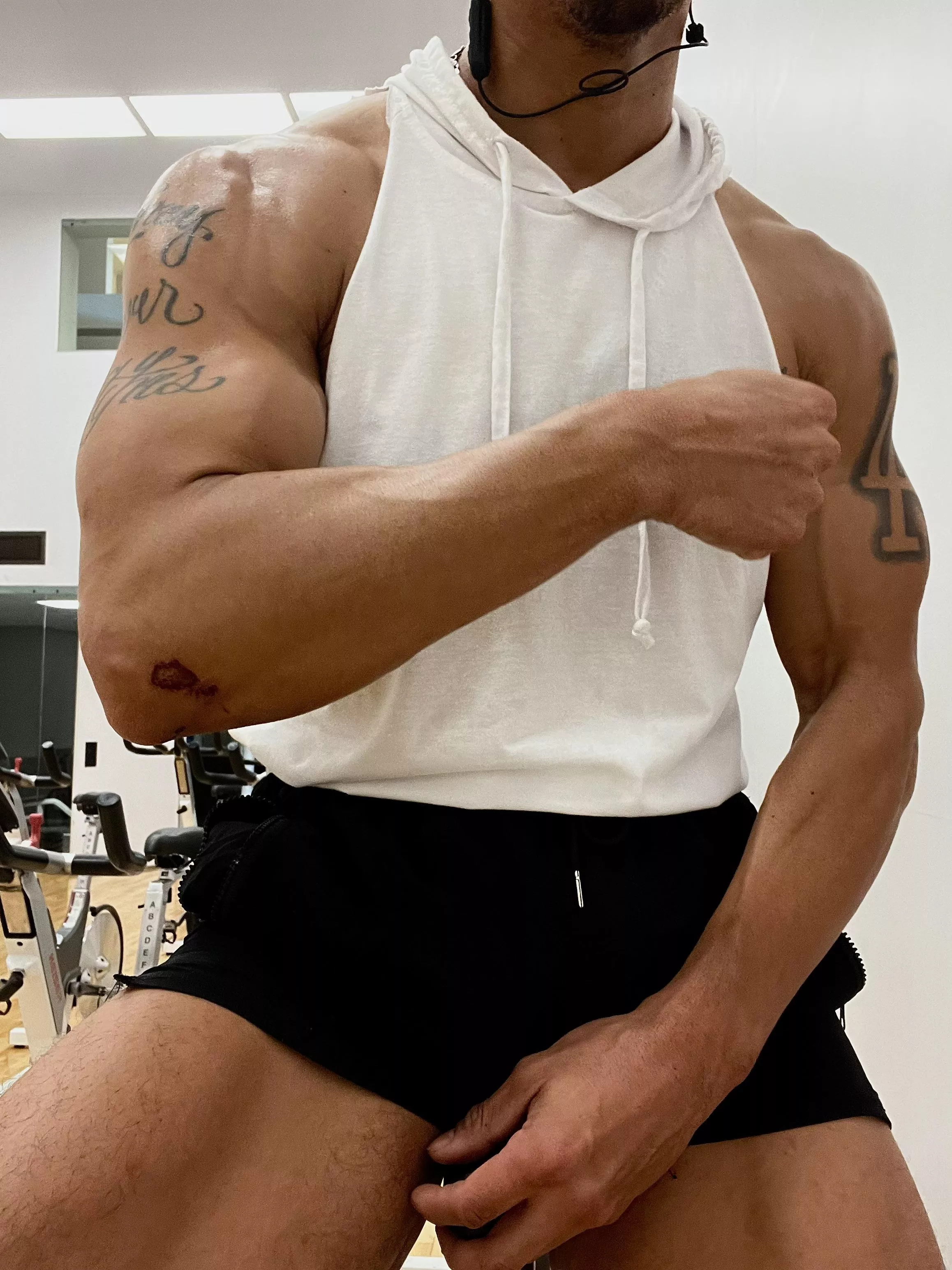 Fell off my bike 😅😂 posted by KingAdonis06