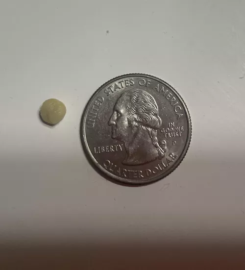 GIANT tonsil stone I found tonight wasn’t expecting it or I would have filmed by Old_Entrepreneur_932