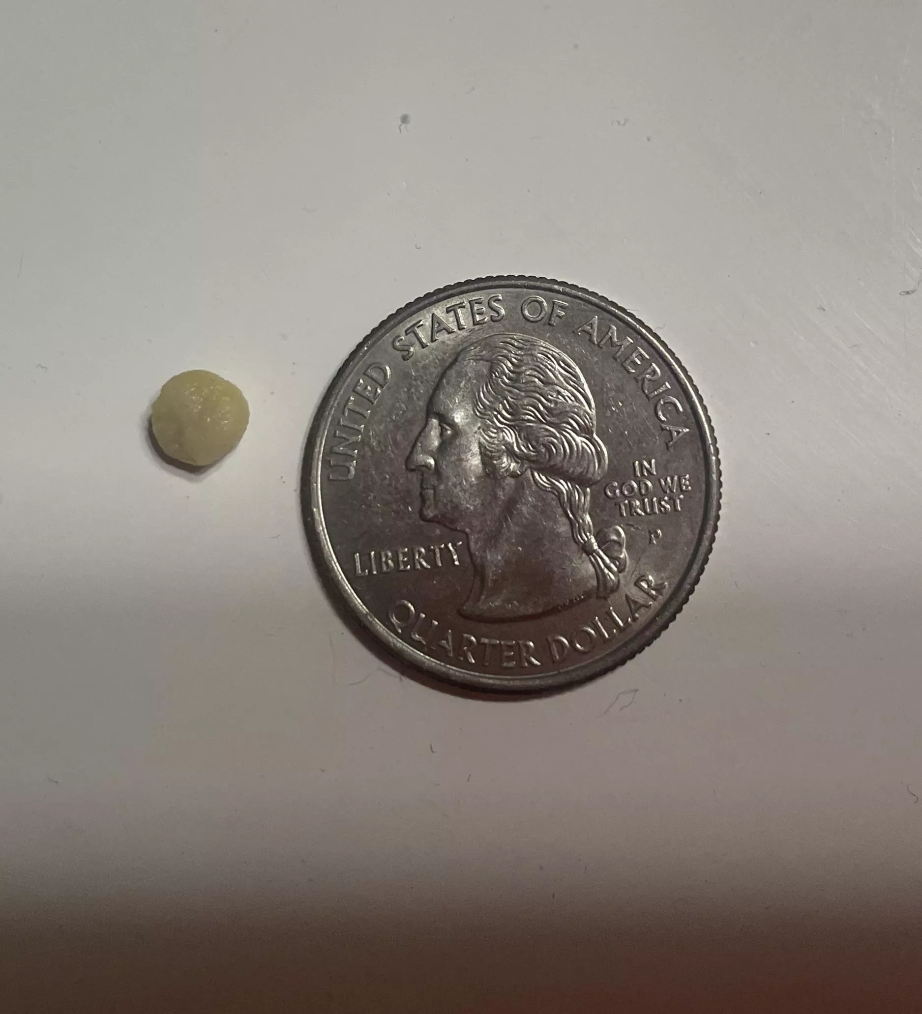 GIANT tonsil stone I found tonight wasn’t expecting it or I would have filmed posted by Old_Entrepreneur_932