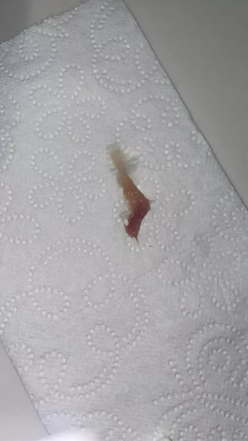 I'm sick, and felt something in my throat, so I pulled this thing out! I felt so much better afterwards. It's the size of a large paper clip irl. ***it's a clump of mucous from my sinuses that drained into my throat! NSFW because i think there is bloo by imnotalesbianiswear
