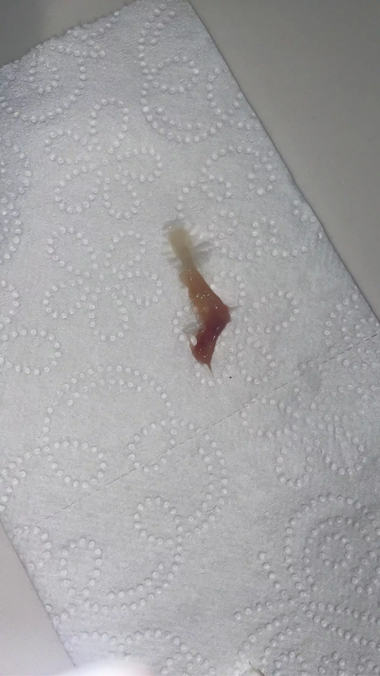 I'm sick, and felt something in my throat, so I pulled this thing out! I felt so much better afterwards. It's the size of a large paper clip irl. ***it's a clump of mucous from my sinuses that drained into my throat! NSFW because i think there is bloo posted by imnotalesbianiswear