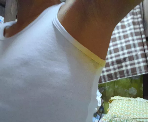My Armpits with Yellow Sweat Stains😓 by Big-Resident-2532