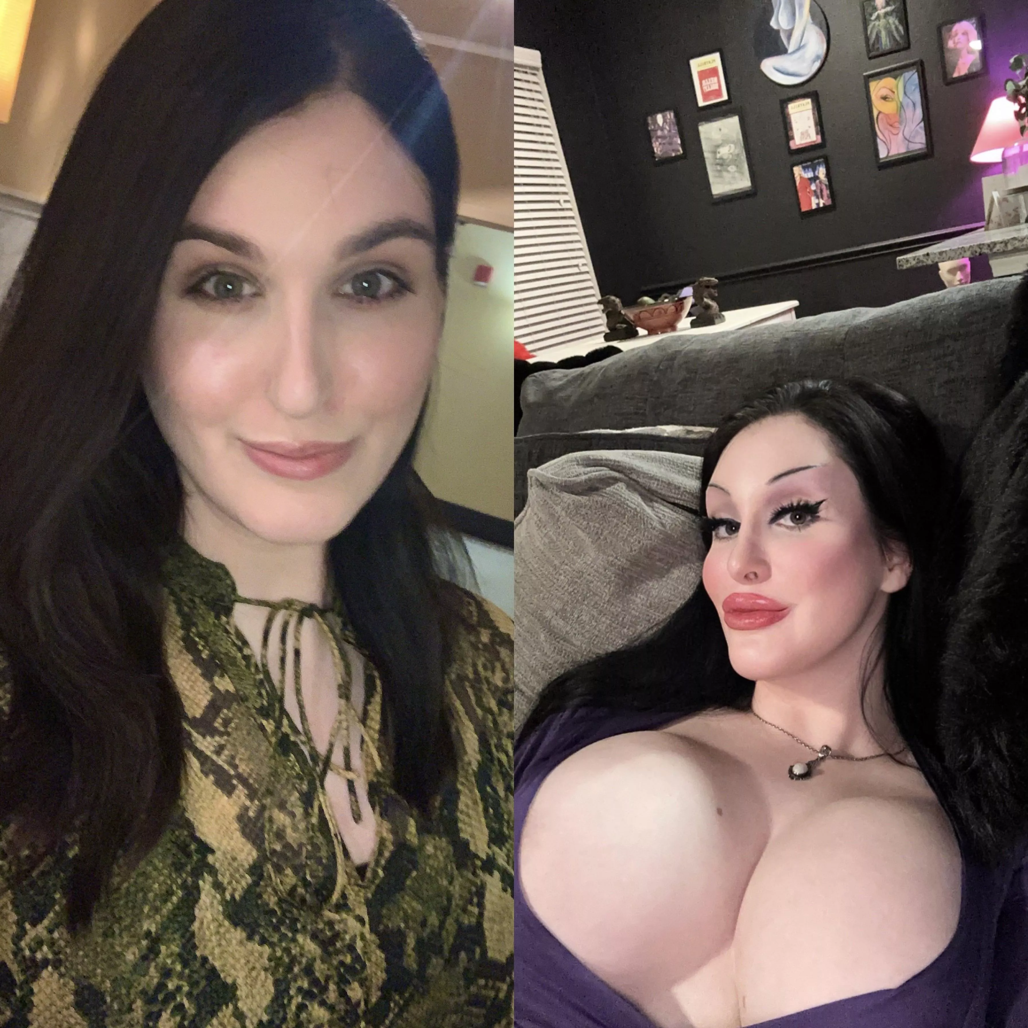 Thought I’d give you all a little update on my bimbo journey! 😘 (Full FFS, 850cc, Lip Fillers, 6 years HRT) Still wanting breast expanders at minimum of 3,500cc and a 360° BBL for next steps! I’ve had my consults already for both! posted by BornToBeHer