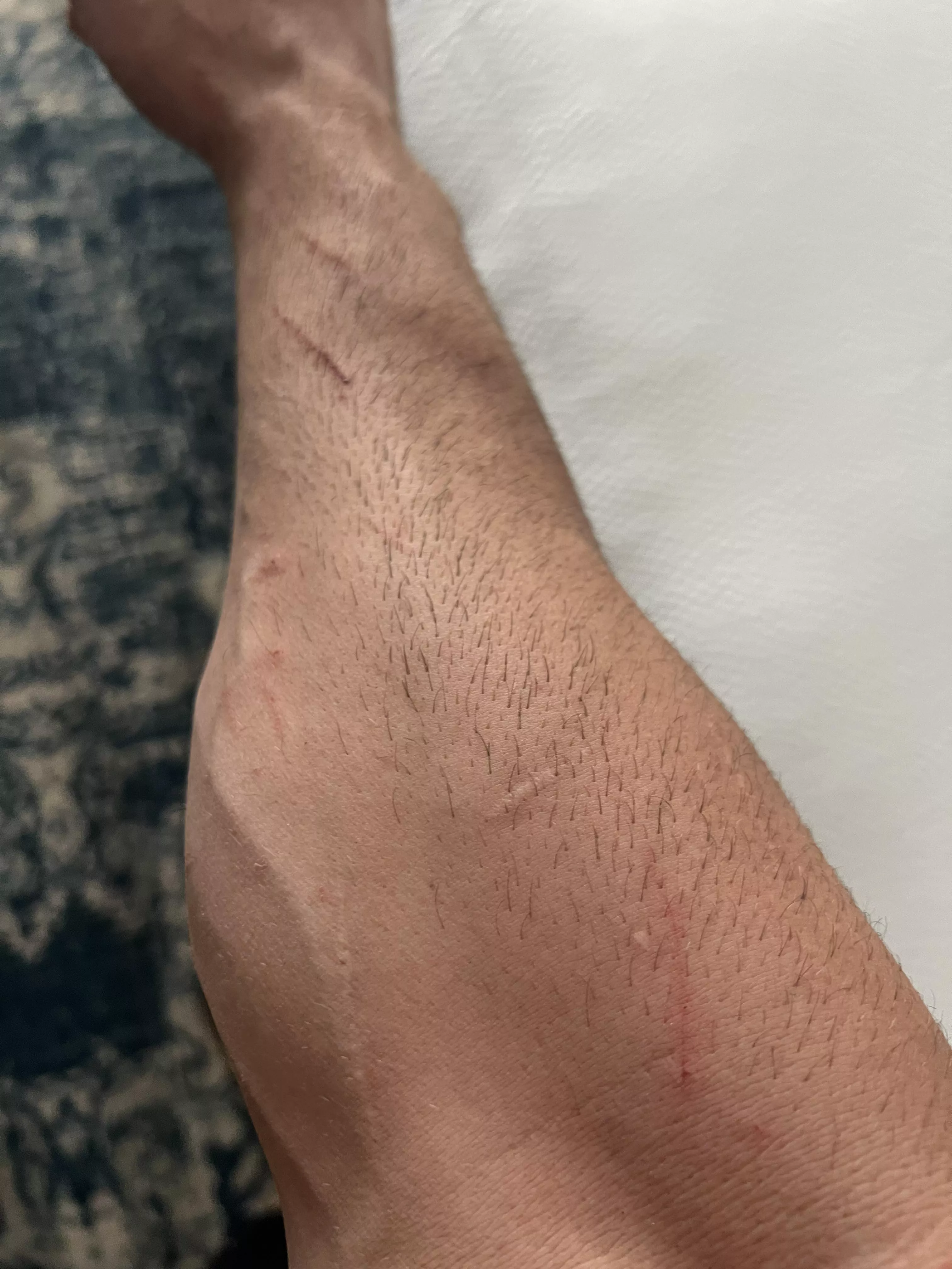 Actual mountain man forearms banged up from a day in the field 😮‍💨 posted by TroyLight