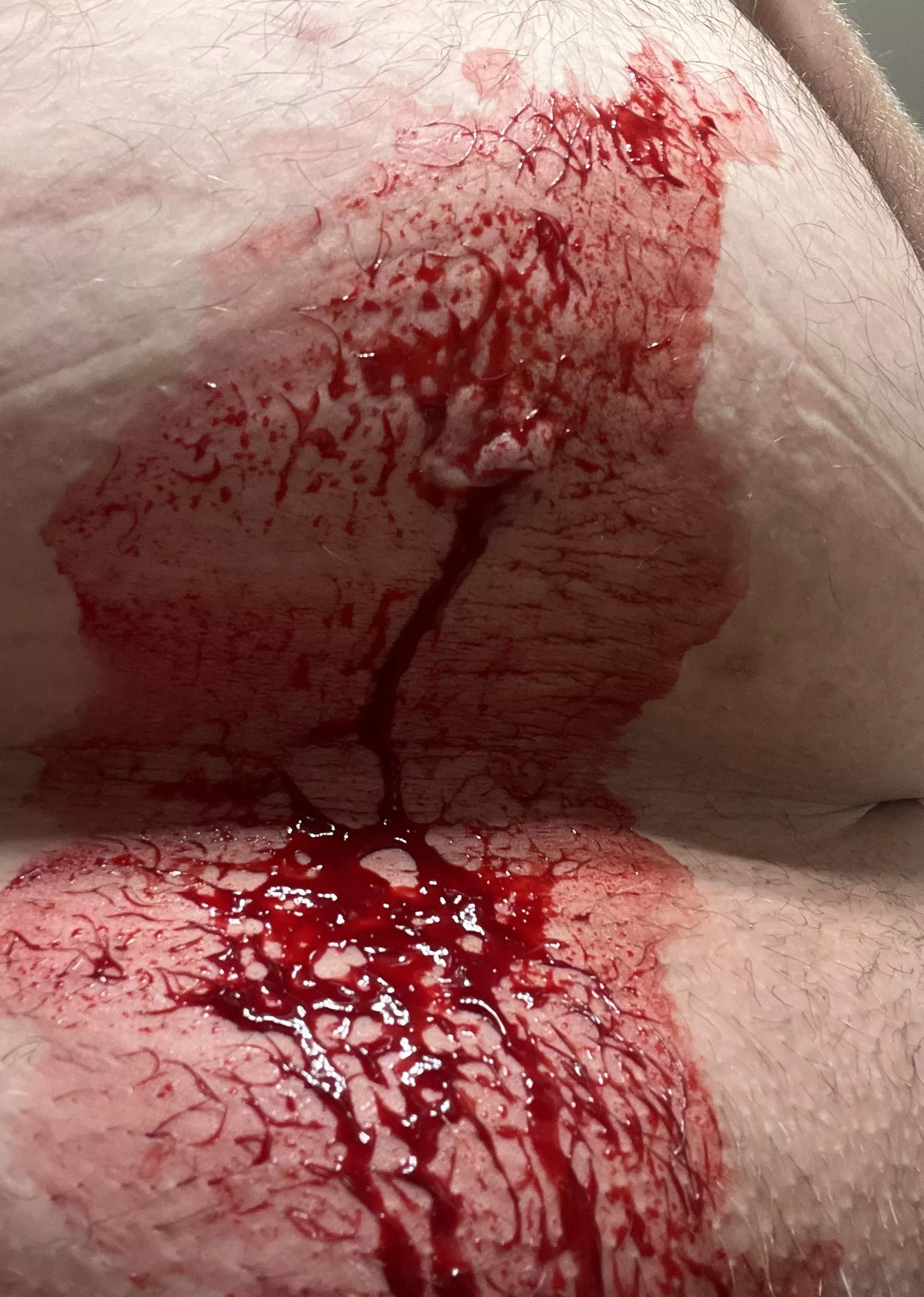 Aftermath of a stomach pop posted by andemyan