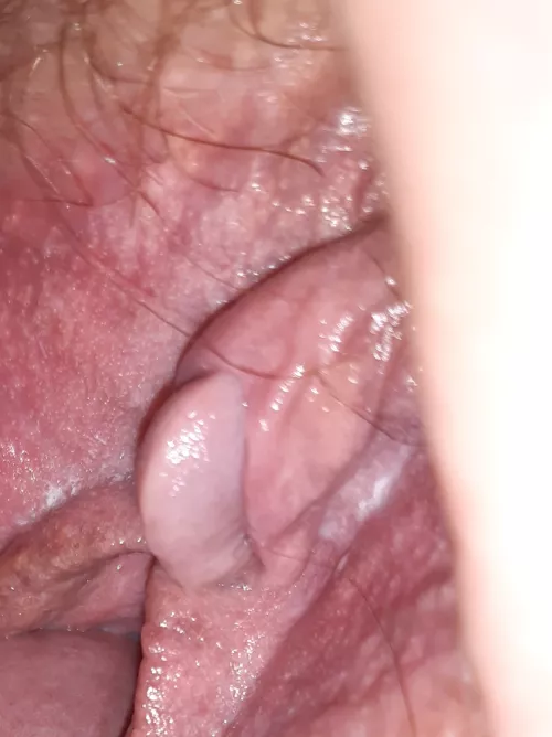 Exposing my clit. by No-Round-6112