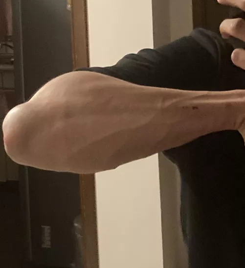 Forearm pump after a climbing session by kebabfrietandalouse
