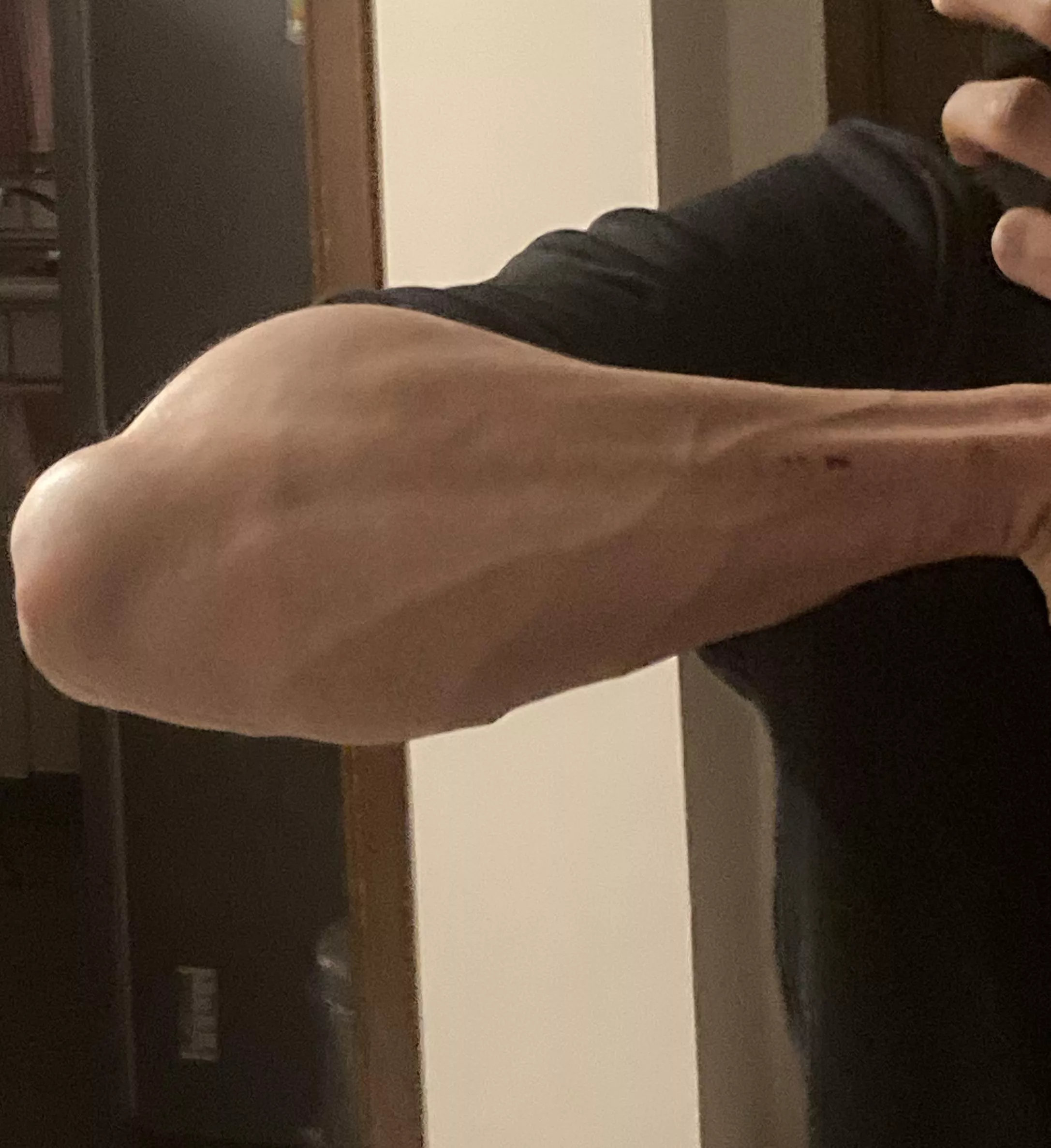 Forearm pump after a climbing session posted by kebabfrietandalouse