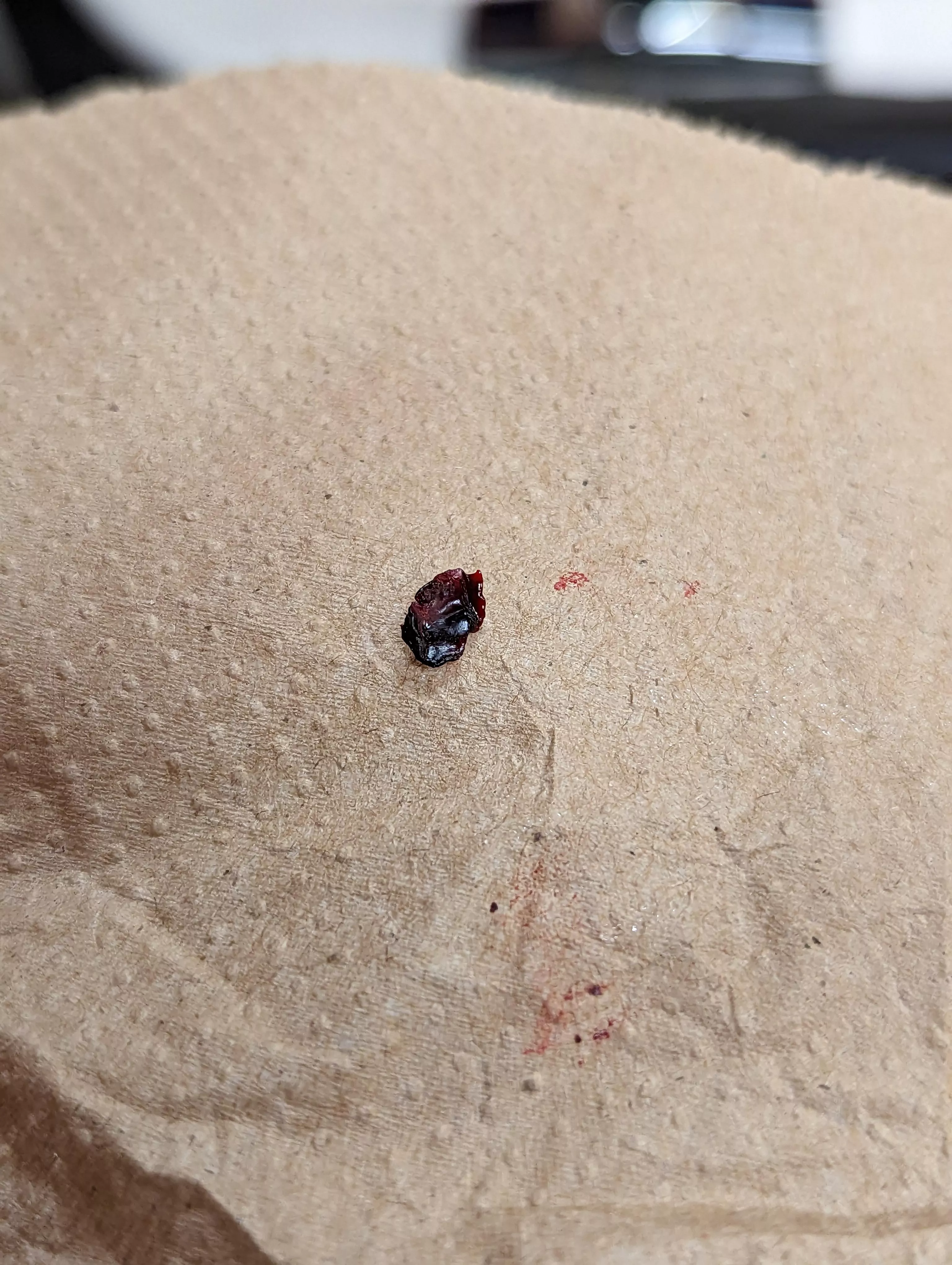 Inner ear scab. Forbidden craisin. posted by WhyLater