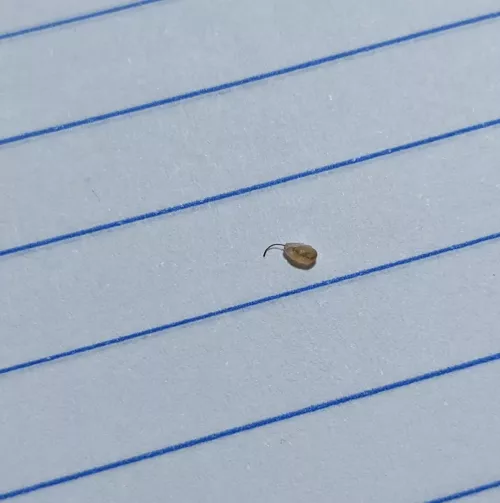 popped this out of my leg, no idea what they are but happens every few weeks. by Mods_Sugg