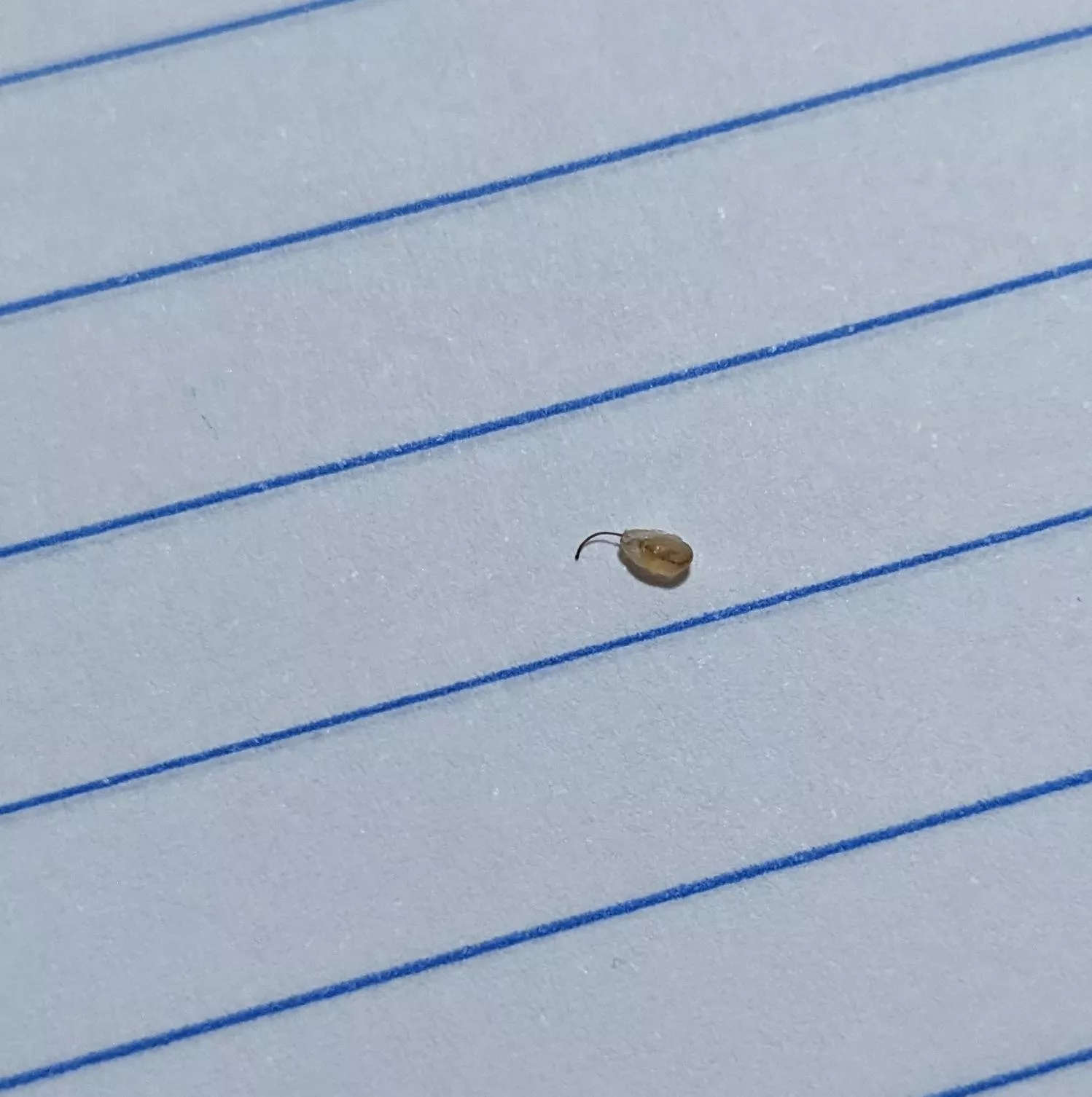 popped this out of my leg, no idea what they are but happens every few weeks. posted by Mods_Sugg