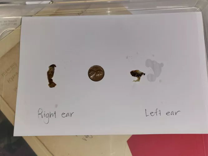 Bought gramma new hearing aids. might not have needed to after inspecting today. hearing doctor recommended upgrades. her entire ear canal was impacted on both sides. we did this at home... by BAGP0I