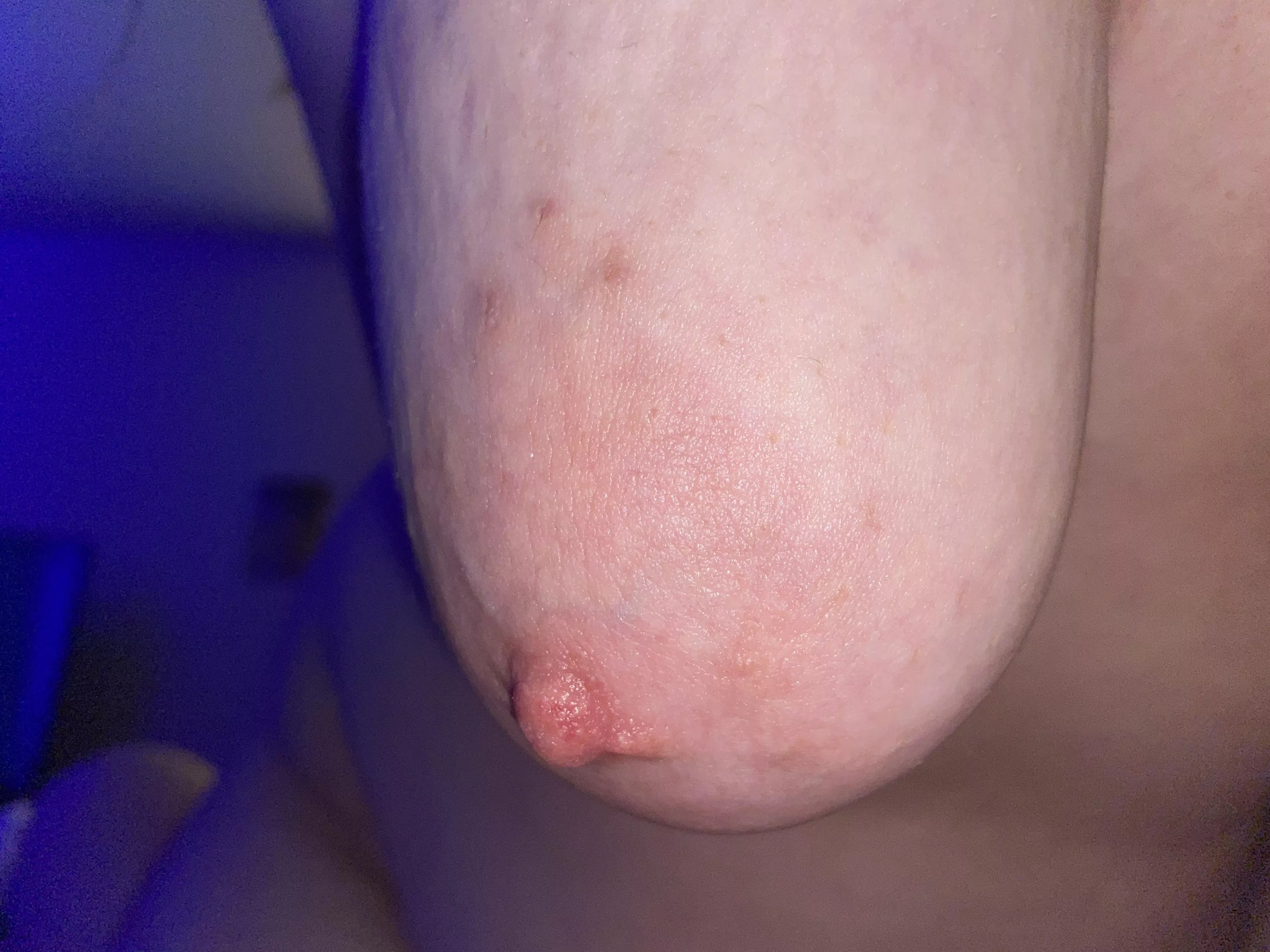 Saggy and right in your face! posted by Ugly_Hoe816