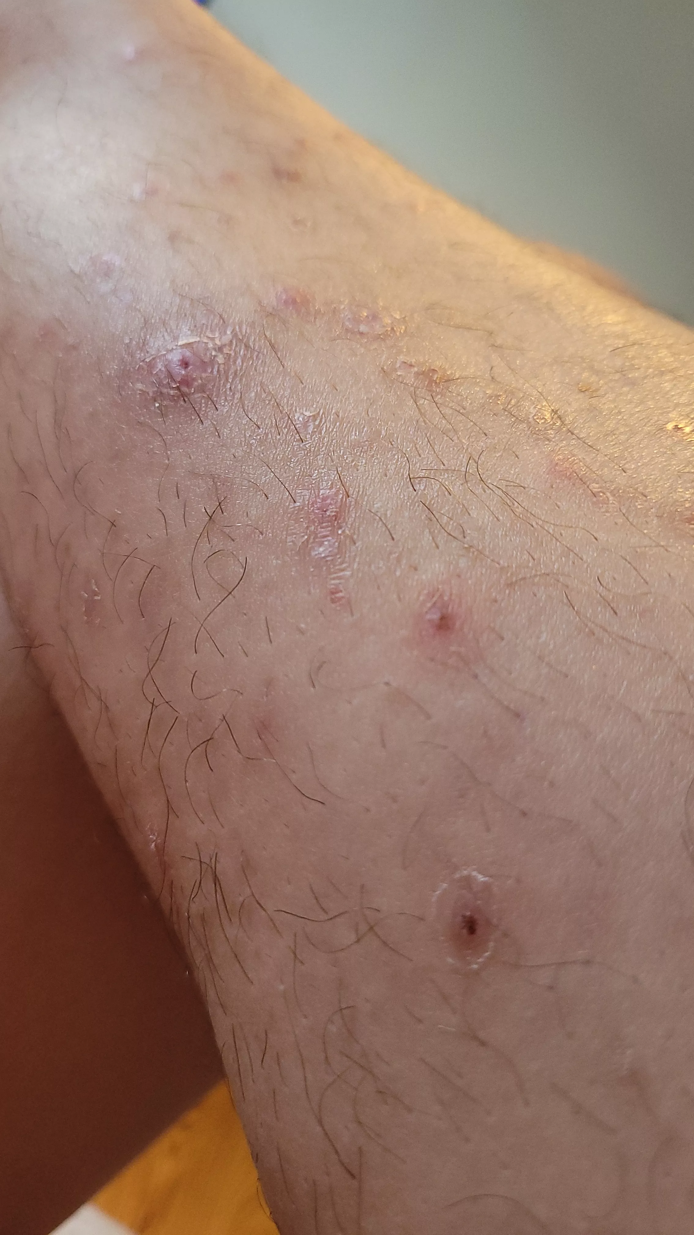 Why am I addicted to popping ? posted by PickyPouic