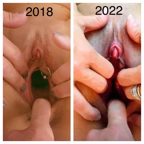 Before and after clit enlargement by FileKlutzy6790