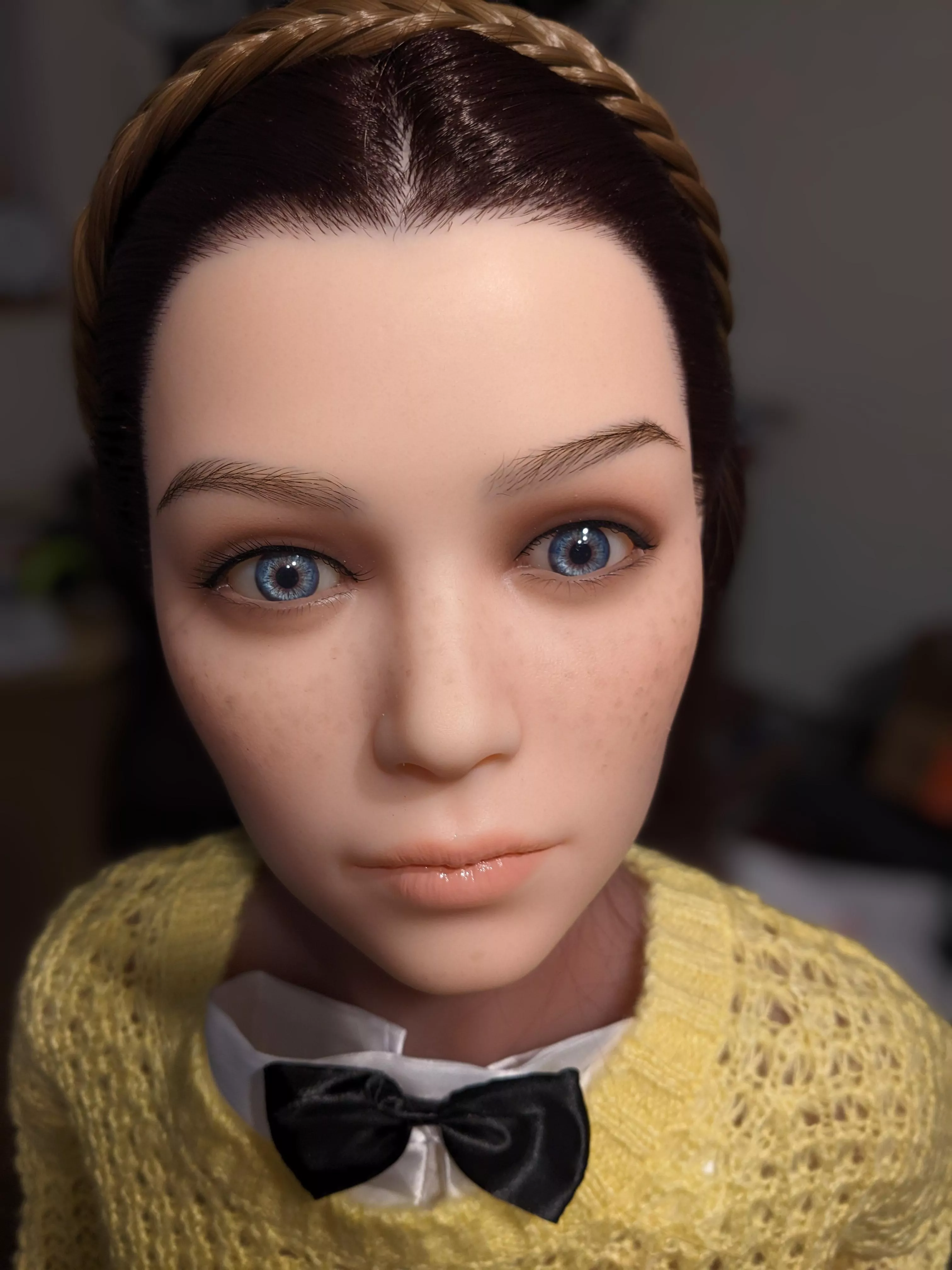 Hair implant and shampoo? posted by No_Gas9517