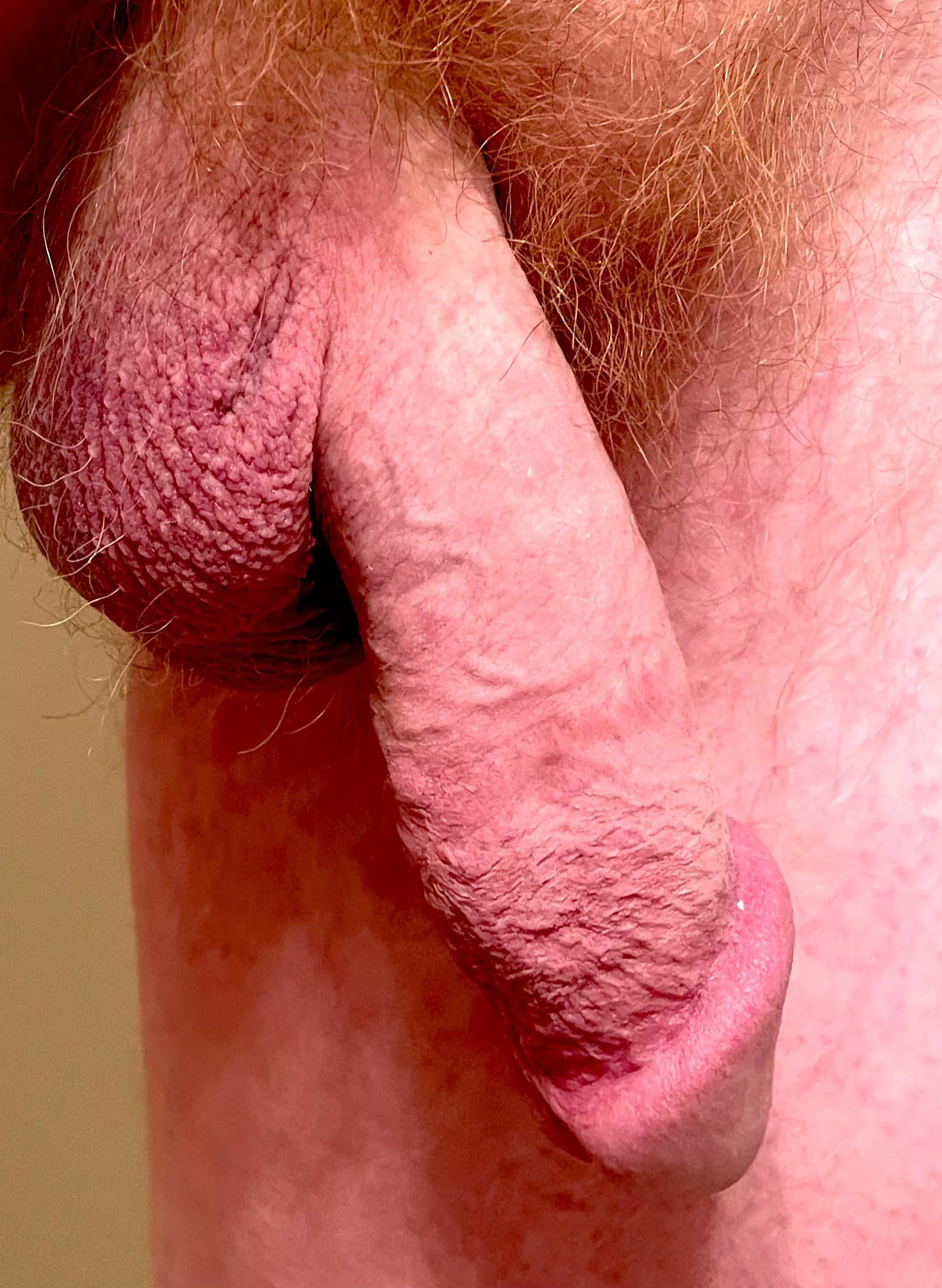 Dangle… posted by Relevant_Junket6404