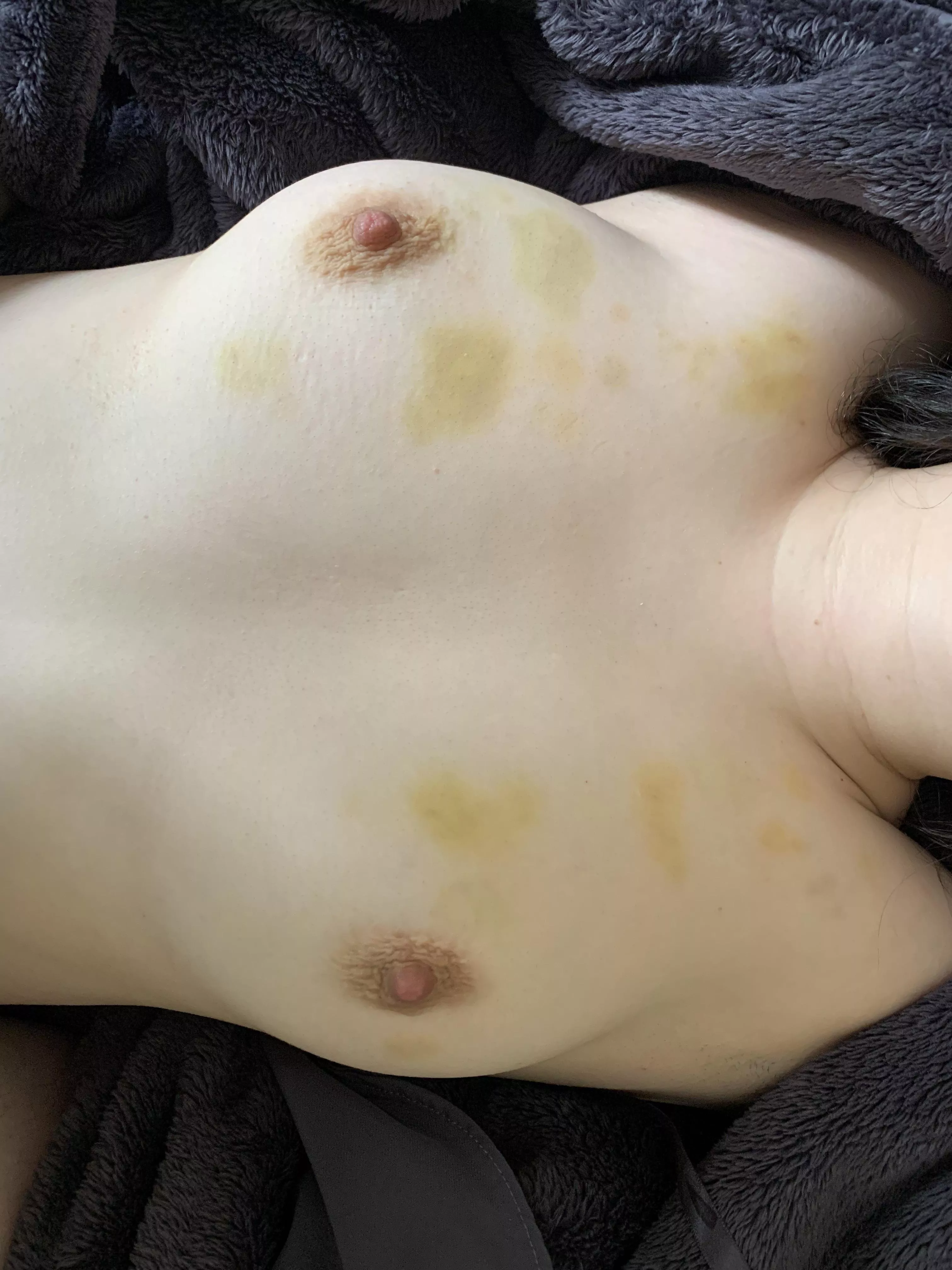 Hmmm love the feeling after a biting session [F24] OC posted by bottomlessbitch