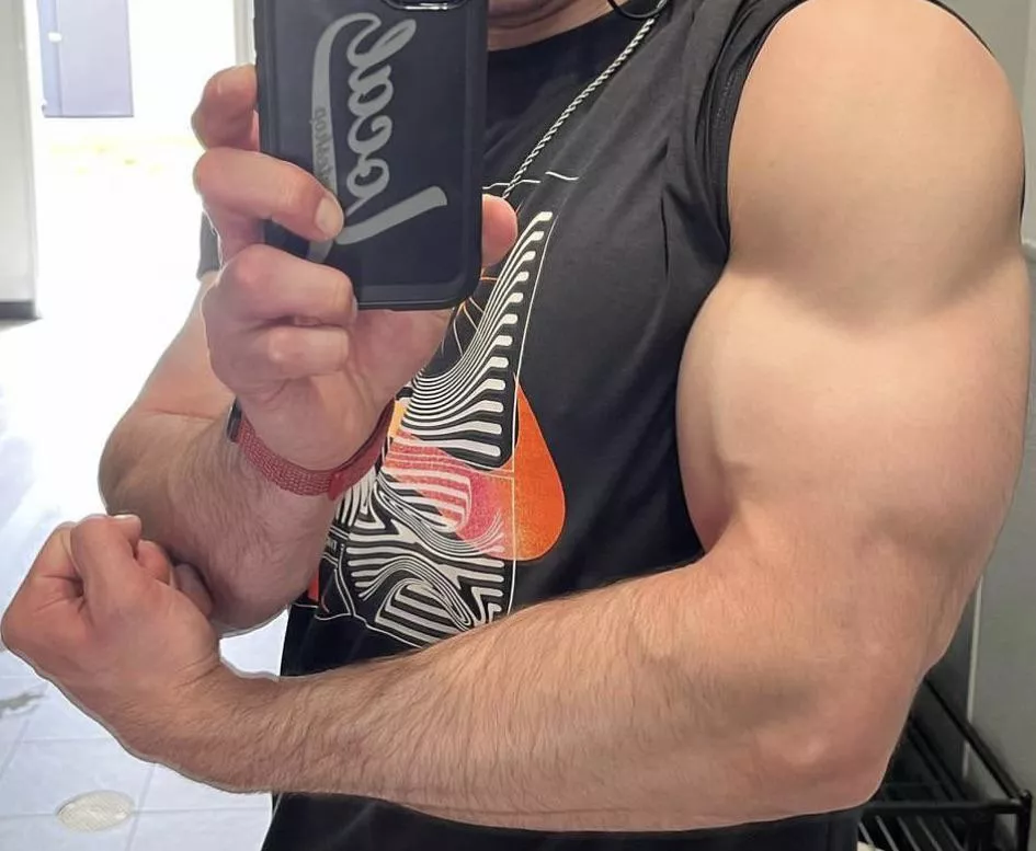 What about my hairy forearm? posted by UnderstandingOk3379