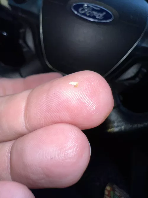 Just popped this from the corner of my mouth! by SweetAddicti0nnn