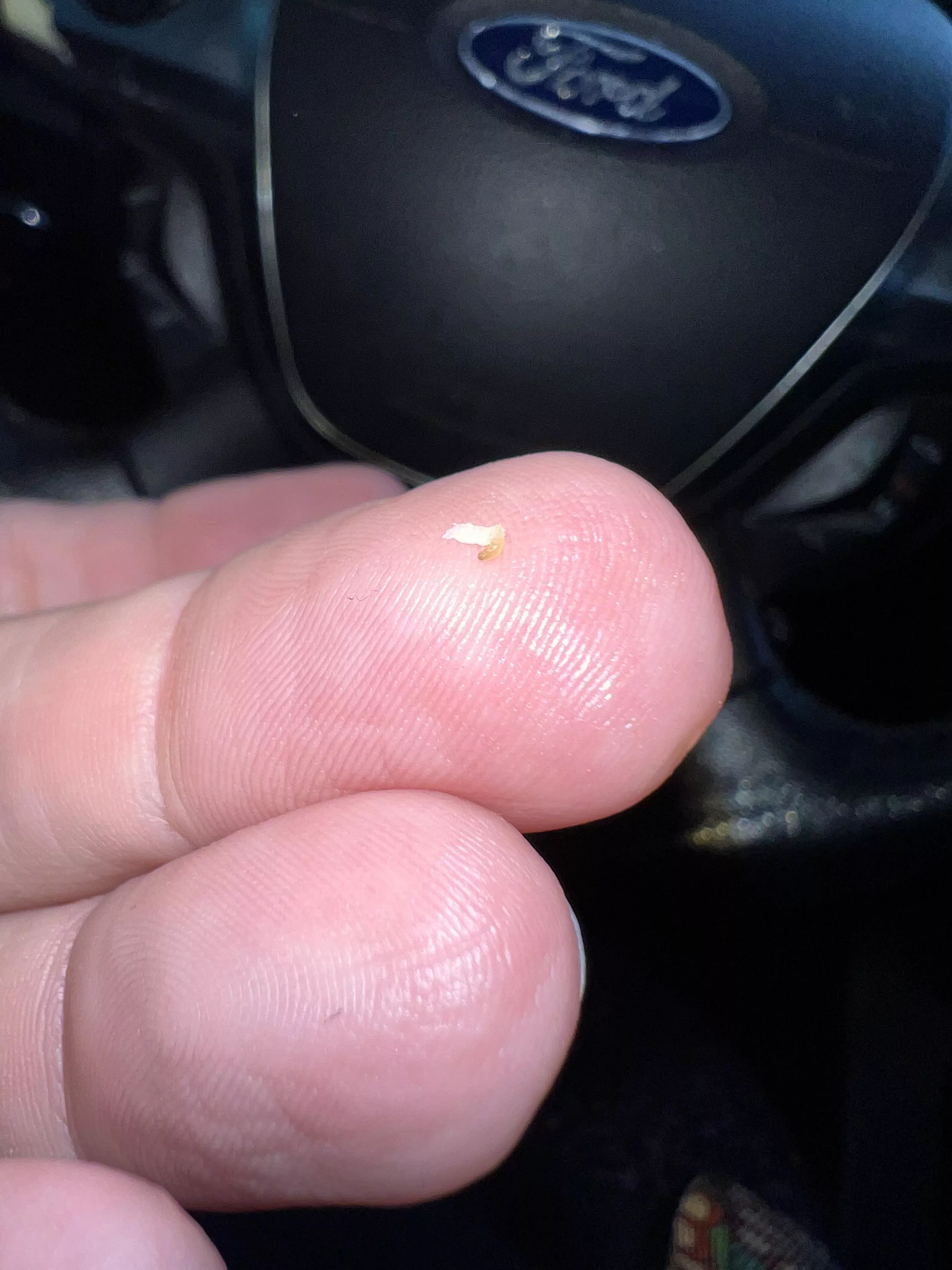 Just popped this from the corner of my mouth! posted by SweetAddicti0nnn