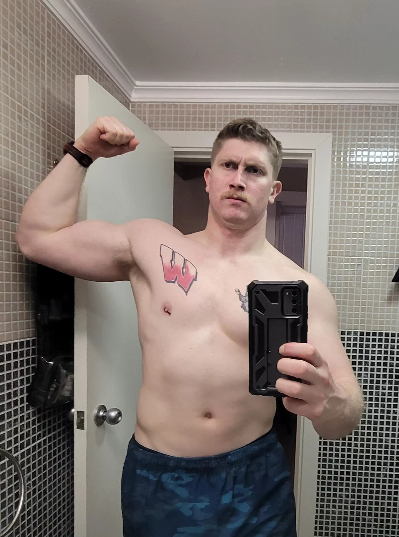 [M] good chect and back day. posted by MammothLengthiness89