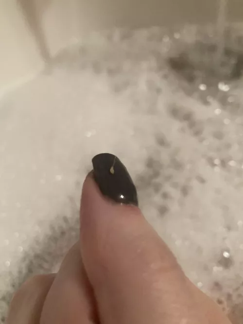 Pulled this bad boy from the back of my leg by courtedge77