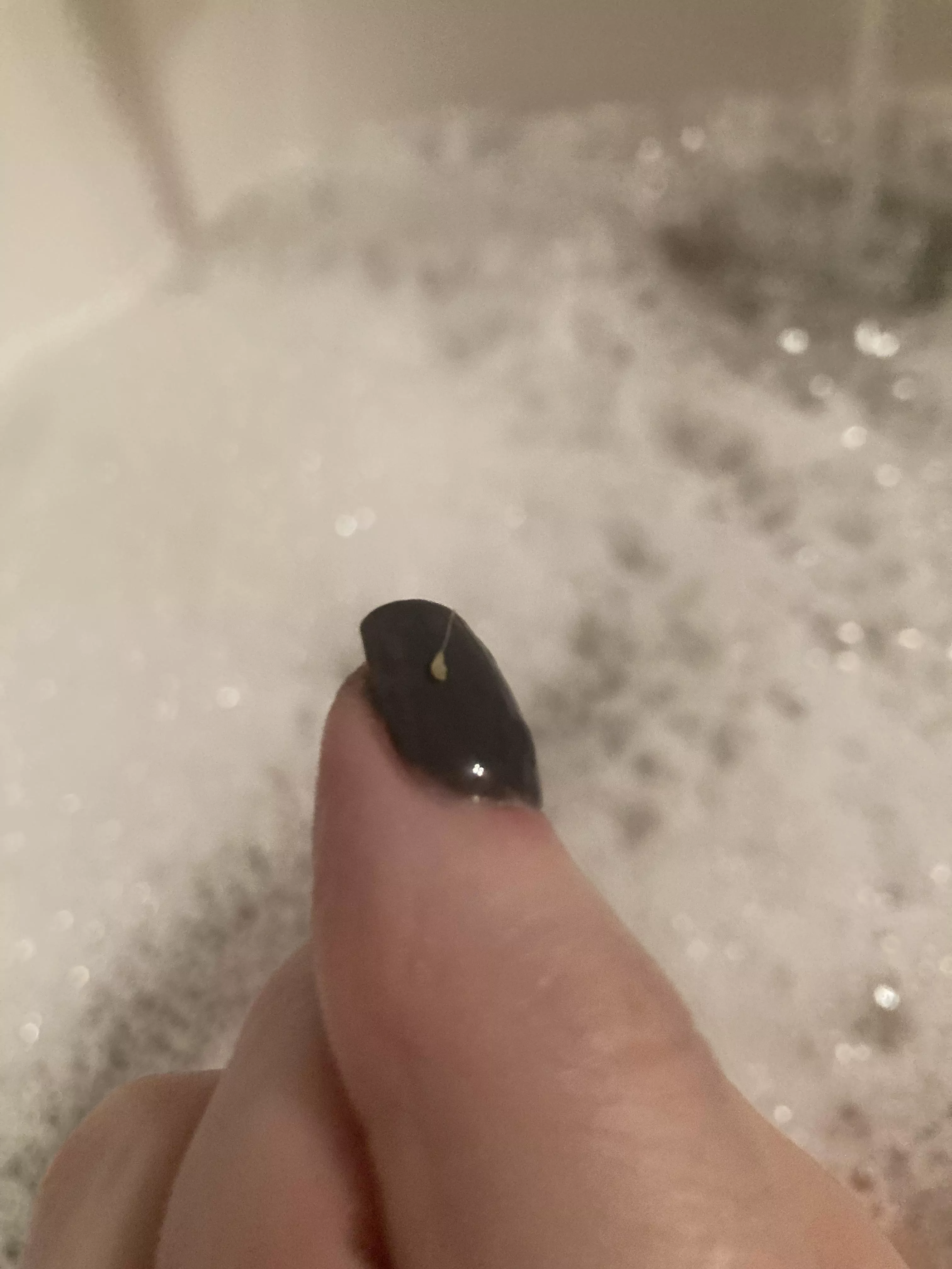 Pulled this bad boy from the back of my leg posted by courtedge77