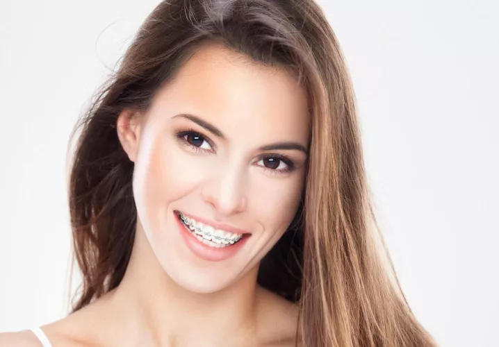 Smiling brunette in braces by Due_Reputation_3525