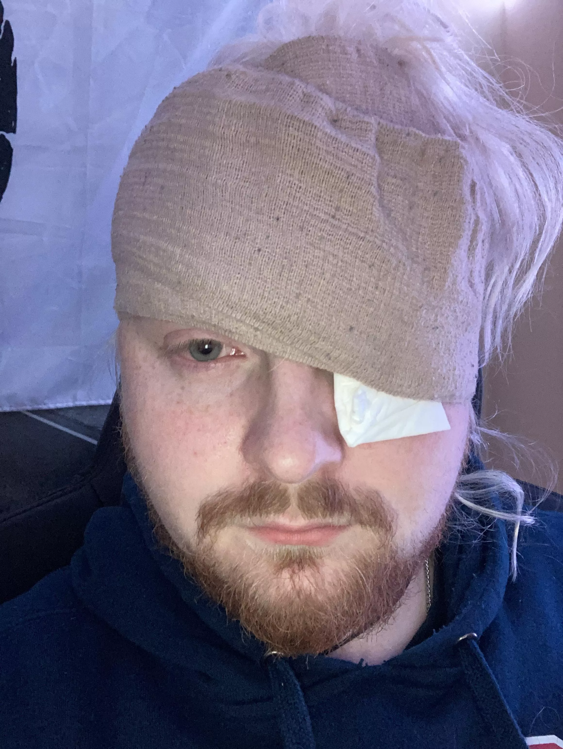 Hoping you fine folks can finally let me know if I’m crazy or not (picture not related, but is from when I had a massive stye (spelling?) and couldn’t find a great way to keep a compress on it and still have use of both hands, and hopefully will be e posted by The-Master-Dwarf