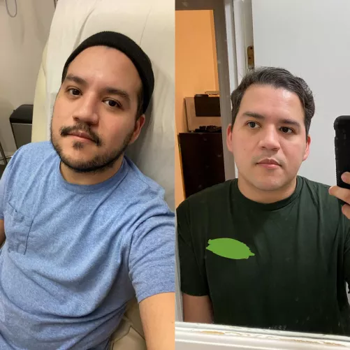 Been dealing with health issues and decided to shave. Needed a pick-me-up. What’s better: unshaven or shaved? by TheTalentedMrK